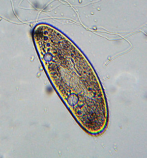 Paramecium multimicronucleatum Photo taken at 400x magnification.

Paramecia are widespread in freshwater. The move very quickly via cilia. Geotagged,Paramecium multimicronucleatum,United States,Winter