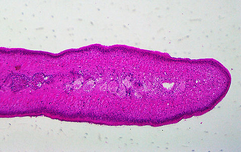 Rabbit (or Dog) Tapeworm - Taenia pisiformis This slide shows a cross-section of gravid tapeworm, which contains eggs. 

Hosts are infected by contaminated feces and food sources.
https://www.jungledragon.com/image/110858/rabbit_or_dog_tapeworm_-_taenia_pisiformis.html Geotagged,Platyhelminthes,Summer,Taenia,Taenia pisiformis,United States,Winter,dog tapeworm,endoparasitic tapeworm,rabbit tapeworm,tapeworm