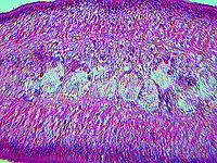 Rabbit (or Dog) Tapeworm - Taenia pisiformis This slide shows a cross-section of gravid tapeworm, which contains eggs.<br />
<br />
Hosts are infected by contaminated feces and food sources.<br />
https://www.jungledragon.com/image/110857/rabbit_or_dog_tapeworm_-_taenia_pisiformis.html Geotagged,Rabbit Tapeworm,Taenia pisiformis,United States,Winter