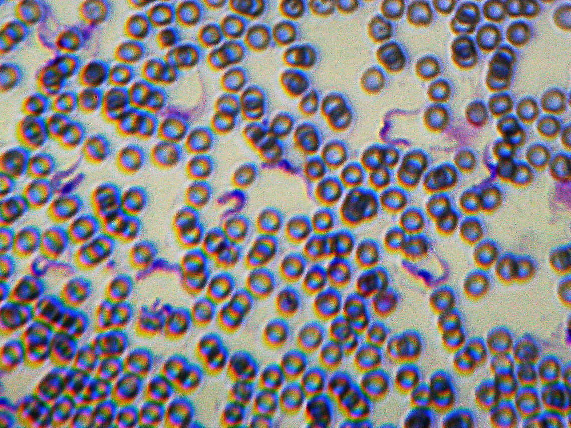 Trypanosoma brucei rhodesiense Smear Sorry for the blurry image! This slide was so hard to focus.  The squiggly bits are the protozoans: The dark part of the nematode is the nucleus and the squiggly end is the flagellum.<br />
<br />
Trypanosoma rhodesiense is a protozoan parasite that causes sleeping sickness. This species causes acute African trypanosomiasis that is quickly deadly. <br />
<br />
Humans can become infected by two types: Trypanosoma brucei gambiense (TbG) and Trypanosoma brucei rhodesiense (TbR). TbG causes over 98% of reported cases. Both forms are transmitted by the bite of an infected tsetse fly (Glossina sp.). Geotagged,Human African Trypanosomiasis,Trypanosoma,Trypanosoma brucei,Trypanosoma rhodesiense,United States,Winter,acute African trypanosomiasis,protozoa,sleeping sickness,trypomastigotes,tsetse fly