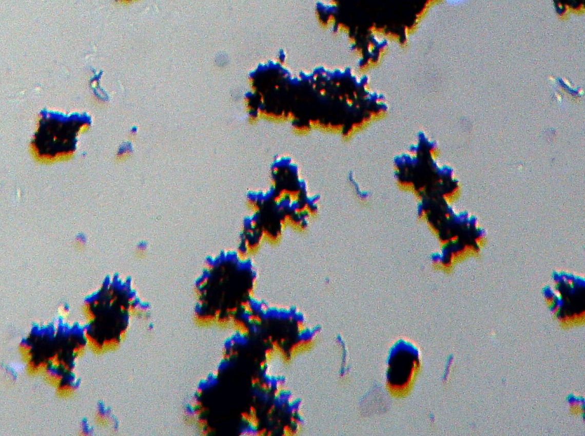 Borrelia burgdorferi Spirochetes This slide shows clumps of Borrelia burgdorferi spirochetes. Borrelia burgdorferi is the bacteria that causes Lyme disease, which is transmitted by ticks (Ixodes sp.).<br />
<br />
(Whole Mount Slide)<br />
<figure class="photo"><a href="https://www.jungledragon.com/image/110993/borrelia_burgdorferi_spirochetes.html" title="Borrelia burgdorferi Spirochetes"><img src="https://s3.amazonaws.com/media.jungledragon.com/images/3232/110993_thumb.jpg?AWSAccessKeyId=05GMT0V3GWVNE7GGM1R2&Expires=1763596810&Signature=E0InASz5I0wy447GIUpST%2F8CNHw%3D" width="200" height="178" alt="Borrelia burgdorferi Spirochetes This slide shows clumps of Borrelia burgdorferi spirochetes. Borrelia burgdorferi is the bacteria that causes Lyme disease, which is transmitted by ticks (Ixodes sp.).<br />
<br />
(Whole Mount Slide)<br />
https://www.jungledragon.com/image/110992/borrelia_burgdorferi_spirochetes.html Borrelia burgdorferi,Geotagged,United States,Winter" /></a></figure> Borrelia,Borrelia burgdorferi,Geotagged,United States,Winter,lyme disease,spirochetes