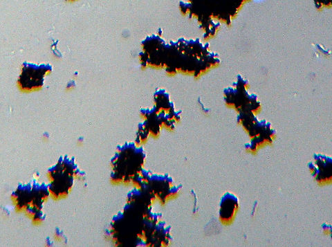 Borrelia burgdorferi Spirochetes This slide shows clumps of Borrelia burgdorferi spirochetes. Borrelia burgdorferi is the bacteria that causes Lyme disease, which is transmitted by ticks (Ixodes sp.).

(Whole Mount Slide)
https://www.jungledragon.com/image/110993/borrelia_burgdorferi_spirochetes.html Borrelia,Borrelia burgdorferi,Geotagged,United States,Winter,lyme disease,spirochetes