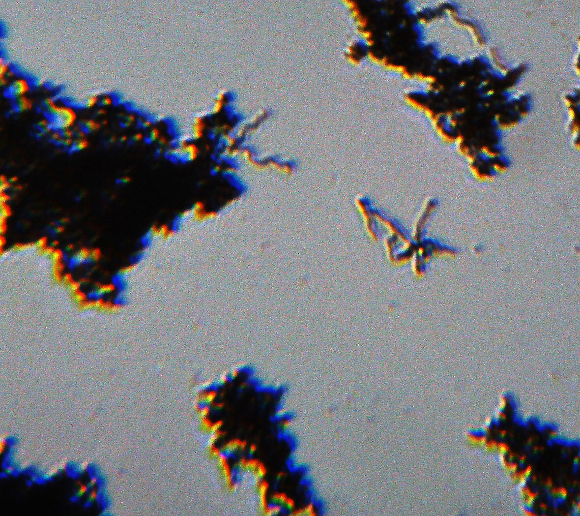 Borrelia burgdorferi Spirochetes This slide shows clumps of Borrelia burgdorferi spirochetes. Borrelia burgdorferi is the bacteria that causes Lyme disease, which is transmitted by ticks (Ixodes sp.).<br />
<br />
(Whole Mount Slide)<br />
<figure class="photo"><a href="https://www.jungledragon.com/image/110992/borrelia_burgdorferi_spirochetes.html" title="Borrelia burgdorferi Spirochetes"><img src="https://s3.amazonaws.com/media.jungledragon.com/images/3232/110992_thumb.jpg?AWSAccessKeyId=05GMT0V3GWVNE7GGM1R2&Expires=1759968010&Signature=ILh51ElYLoAsQsfH2jiD0RwH3gQ%3D" width="200" height="150" alt="Borrelia burgdorferi Spirochetes This slide shows clumps of Borrelia burgdorferi spirochetes. Borrelia burgdorferi is the bacteria that causes Lyme disease, which is transmitted by ticks (Ixodes sp.).<br />
<br />
(Whole Mount Slide)<br />
https://www.jungledragon.com/image/110993/borrelia_burgdorferi_spirochetes.html Borrelia,Borrelia burgdorferi,Geotagged,United States,Winter,lyme disease,spirochetes" /></a></figure> Borrelia burgdorferi,Geotagged,United States,Winter