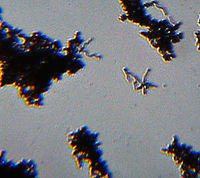 Borrelia burgdorferi Spirochetes This slide shows clumps of Borrelia burgdorferi spirochetes. Borrelia burgdorferi is the bacteria that causes Lyme disease, which is transmitted by ticks (Ixodes sp.).<br />
<br />
(Whole Mount Slide)<br />
https://www.jungledragon.com/image/110992/borrelia_burgdorferi_spirochetes.html Borrelia burgdorferi,Geotagged,United States,Winter