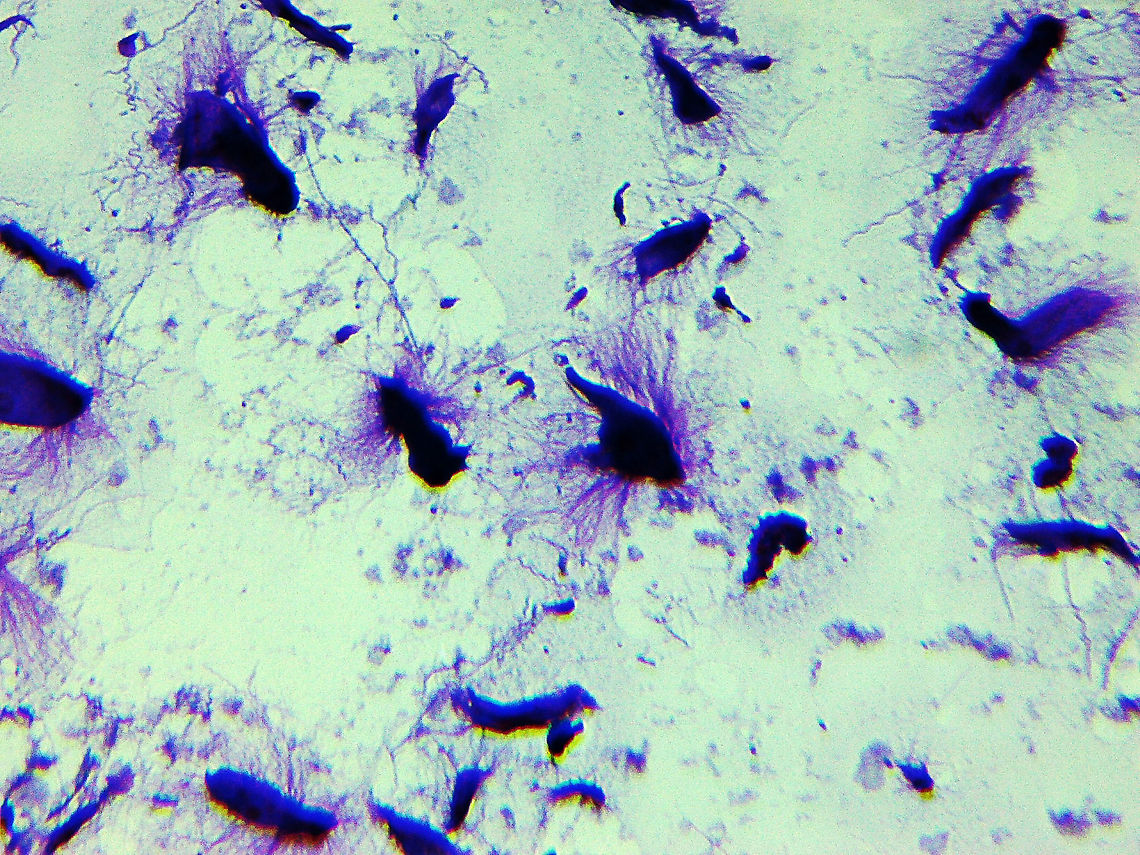 Termite Flagellates - Trichonympha sp. This slide shows symbiotic protists from the digestive system of a termite! These flagellates digest cellulose, thus allowing their host (termites) to subsist on a diet of wood. In exchange, the protists receive a constant supply of food and shelter.<br />
<br />
The "hairs" coming off the protists are flagella...they have tons of them.<br />
<br />
*Whole mount slide Geotagged,United States,Winter,bacterial endosymbiont,endomicrobia,protist,protista,symbiosis,termite,termite flagellates,trichonympha