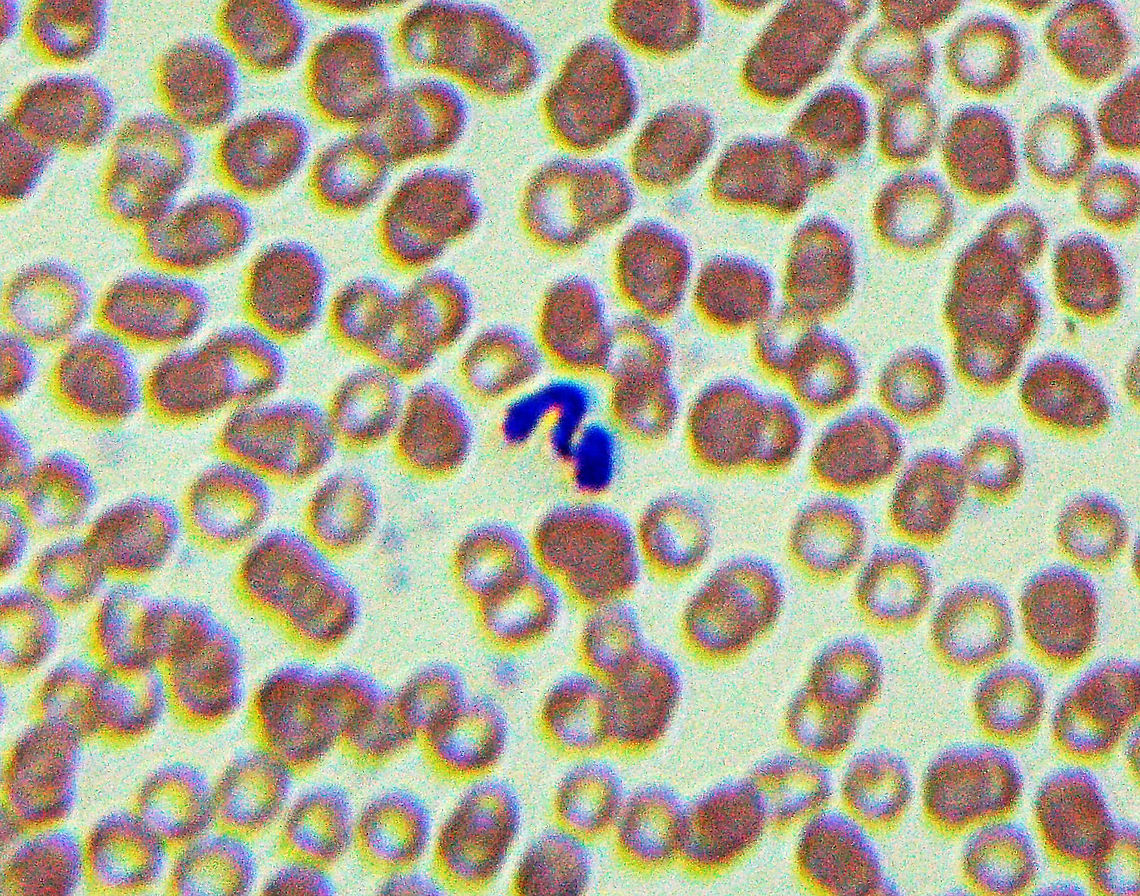 Dog Heartworm - Dirofilaria immitis The blue squiggle on this slide is Dirofilaria immitis, which causes dog heartworm. It infects the lung arteries and heart of its host, eventually leading to death. The definitive host is the dog, but it can also infect other animals such as cats, foxes, and bears. It is transmitted by mosquitoes in the genera Aedes, Culex, Anopheles, and Mansonia.<br />
<br />
There are numerous drugs available to prevent infection.<br />
<br />
*Slide is a blood smear  Dirofilaria,Dirofilaria immitis,Geotagged,Onchocercidae,United States,Winter,arthropod-borne disease,dirofilariasis,dog heartworm,filarial worm,heartworm,parasitic roundworm,roundworm