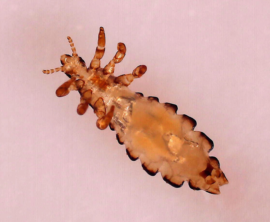 Human Body Louse - Pediculus humanus humanus The body louse is one of three types of lice that infest humans. The other two are the head louse and the pubic louse. They can transmit pathogens that cause human diseases, such as epidemic typhus.<br />
<br />
*Whole mount slide<br />
<figure class="photo"><a href="https://www.jungledragon.com/image/111771/human_body_louse_-_pediculus_humanus_humanus.html" title="Human Body Louse - Pediculus humanus humanus"><img src="https://s3.amazonaws.com/media.jungledragon.com/images/3232/111771_thumb.jpg?AWSAccessKeyId=05GMT0V3GWVNE7GGM1R2&Expires=1767225610&Signature=55urK9kOHVjO6449bZ%2B2UUrT8nY%3D" width="200" height="158" alt="Human Body Louse - Pediculus humanus humanus The body louse is one of three types of lice that infest humans. The other two are the head louse and the pubic louse. They can transmit pathogens that cause human diseases, such as epidemic typhus. <br />
<br />
*Whole mount slide<br />
https://www.jungledragon.com/image/111775/human_body_louse_-_pediculus_humanus_humanus.html Geotagged,Pediculus,Pediculus humanus,Pediculus humanus humanus,United States,ectoparasite,hematophagic ectoparasite,lice,louse" /></a></figure> Geotagged,Pediculus humanus,United States