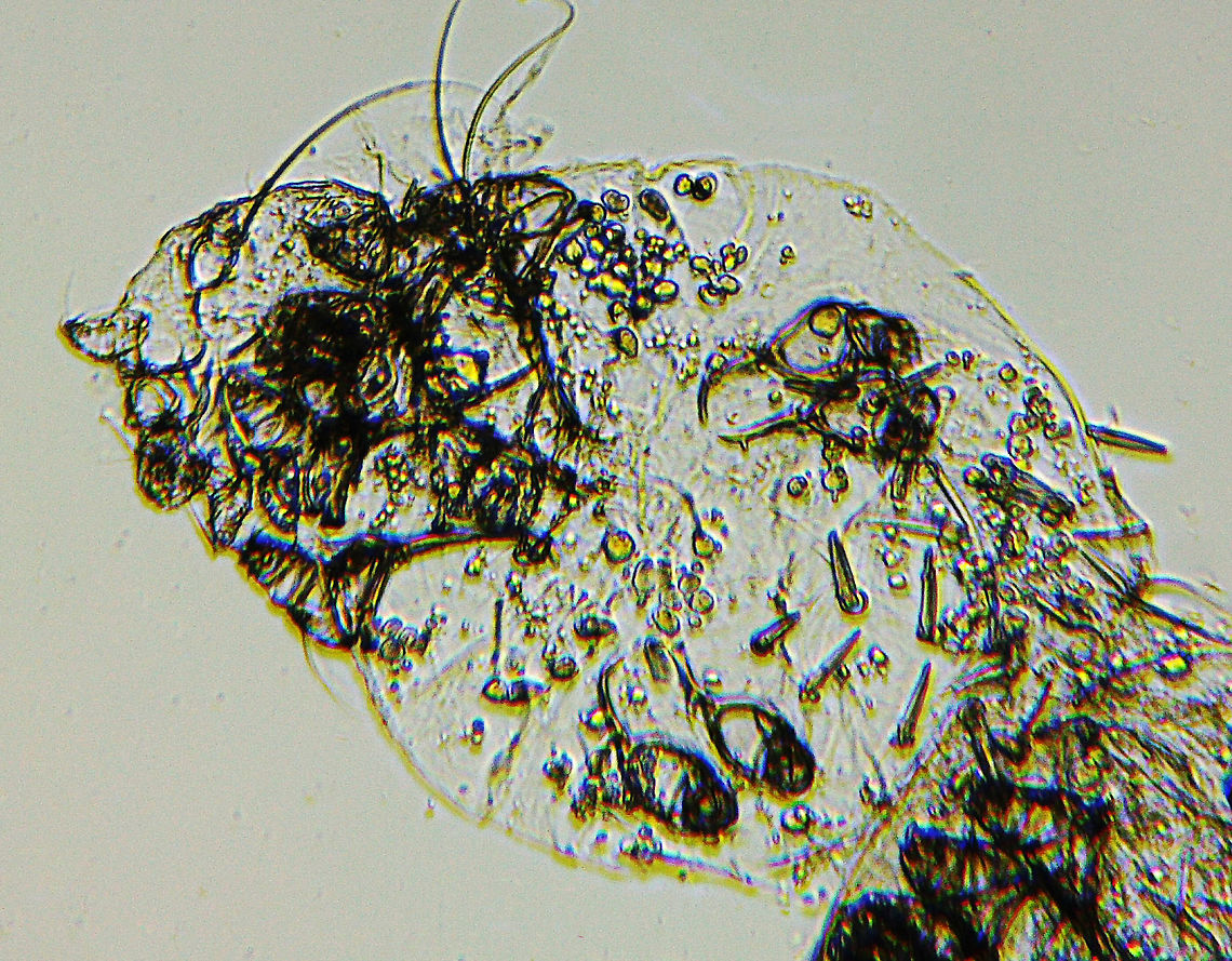 Itch Mite - Sarcoptes scabei Description -- The head is to the left. The protuberances on the body are legs. In the lower middle (below the legs) are spines. There is a partial view of another mite in the lower right corner.<br />
<br />
These mites burrow into the skin and cause scabies. They infect humans, in addition to other mammals. The stages of infestation are thus: a fertilized female burrows into the host's skin, laying eggs in tunnels. The eggs hatch and the larvae feed and molt in hair follicles. They cause intense itching, which can lead to infection.<br />
<br />
*whole mount microscope slide Geotagged,Sarcoptes,Sarcoptes scabei,Sarcoptes scabiei,United States,Winter,itch mite,mite,parasitic mite,scabies mite