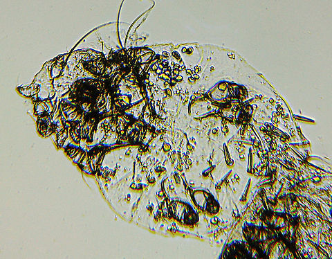 Itch Mite - Sarcoptes scabei Description -- The head is to the left. The protuberances on the body are legs. In the lower middle (below the legs) are spines. There is a partial view of another mite in  the lower right corner.

These mites burrow into the skin and cause scabies. They infect humans, in addition to other mammals. The stages of infestation are thus: a fertilized female burrows into the host's skin, laying eggs in tunnels. The eggs hatch and the larvae feed and molt in hair follicles. They cause intense itching, which can lead to infection.

*whole mount microscope slide Geotagged,Sarcoptes,Sarcoptes scabei,Sarcoptes scabiei,United States,Winter,itch mite,mite,parasitic mite,scabies mite