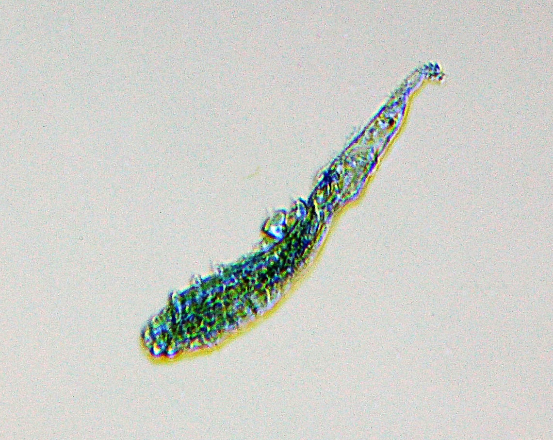 Follicle Mite - Demodex folliculorum This is a follicle mite. It has a worm-like shape with its head at the bottom left in this photo.<br />
<br />
Don&#039;t panic, but everyone (humans) has these mites on their skin -- they are microscopic, so you can&#039;t see them. The average person may have up to 3 million mites on their bodies.<br />
<br />
These mites usually don&#039;t do any harm and are actually beneficial in that they feast on sebum (oil) in the sebaceous glands. Babies aren&#039;t born with mites, but likely acquire them from their mothers. They tend to be found in higher concentrations on faces -- forehead, nose, ear, and eyelashes.  They basically eat your grease, which is not a bad thing.<br />
<br />
Occasionally, a mite may block a gland, leading to a build-up of bacteria and causing infection. Their dead bodies can also cause an immune response, although this is not common. <br />
<br />
Fun fact: They do not have anuses. Their lives end when their bodies explode from being full of waste.<br />
<br />
*Whole mount microscope slide<br />
 Demodex,Demodex folliculorum,Geotagged,United States,Winter,demodicosis,follicle mite,mite