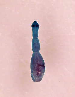 Dog Tapeworm - Echinococcus granulosus Slide shows an adult tapeworm. It's 4 mm long and has 4 proglottids (segments). A gravid tapeworm can contain 823 eggs.

Dogs are the definitive host. The tapeworms are ingested by dogs and travel to the intestines, where they become attached. It is fairly harmless to a dog, but it can become a serious problem if a human is infected...this can happen when humans have close contact with infected dogs. Human infection can lead to abnormal organ function, spontaneous fracture of bones, and neurological effects.

*Whole mount microscope slide Echinococcus,Echinococcus granulosus,Geotagged,United States,cestode,dog tapeworm,hydatid worm,hyper tape-worm,tapeworm