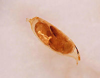 Fruit Fly Pupa - Drosophila melanogaster *Whole mount slide<br />
https://www.jungledragon.com/image/113102/fruit_fly_-_drosophila_melanogaster.html Drosophila,Drosophila melanogaster,Geotagged,United States,fruit fly pupa,pupa