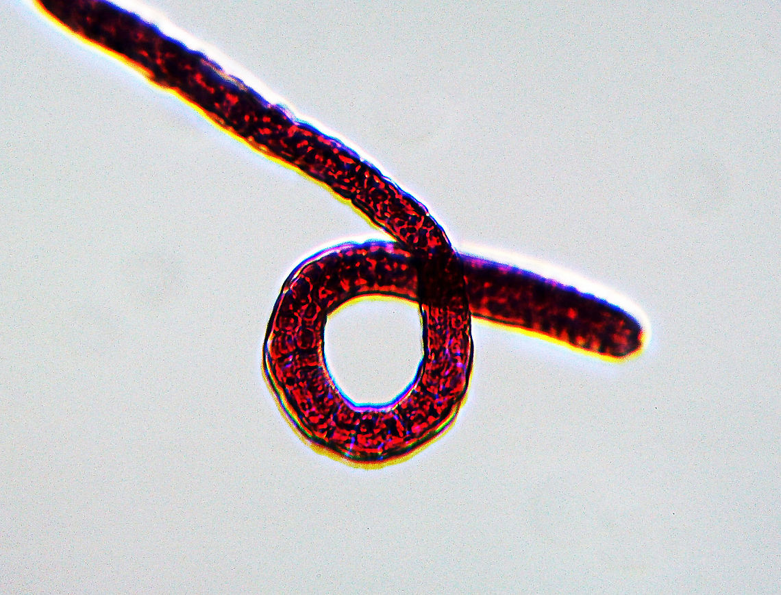 Pork Worm (Female) - Trichinella spiralis Pork worm is a parasite of rodents, pigs, bears, hyenas, and humans It causes the disease trichinosis. It is acquired when a host eats undercooked, infected meat. Usually, the infection is minor and causes diarrhea, abdominal pain, and vomiting. But, complications can occur.<br />
<br />
*Microscope whole mount slide<br />
<figure class="photo"><a href="https://www.jungledragon.com/image/114307/pork_worm_female_-_trichinella_spiralis.html" title="Pork Worm (Female) - Trichinella spiralis"><img src="https://s3.amazonaws.com/media.jungledragon.com/images/3232/114307_thumb.jpg?AWSAccessKeyId=05GMT0V3GWVNE7GGM1R2&Expires=1759968010&Signature=ygwpPbqsLgE8cLj5NcTZRLb760Y%3D" width="200" height="152" alt="Pork Worm (Female) - Trichinella spiralis Pork worm is a parasite of rodents, pigs, bears, hyenas, and humans It causes the disease trichinosis. It is acquired when a host eats undercooked, infected meat. Usually, the infection is minor and causes diarrhea, abdominal pain, and vomiting. But, complications can occur.<br />
<br />
*Microscope whole mount slide<br />
https://www.jungledragon.com/image/114306/pork_worm_female_-_trichinella_spiralis.html Geotagged,Trichinella,Trichinella spiralis,United States,Winter,nematode,pork worm,trichinosis" /></a></figure> Geotagged,Trichinella,Trichinella spiralis,United States,Winter,nematode,pork worm