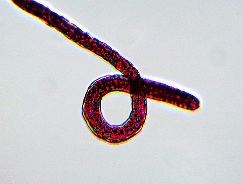 Pork Worm (Female) - Trichinella spiralis Pork worm is a parasite of rodents, pigs, bears, hyenas, and humans It causes the disease trichinosis. It is acquired when a host eats undercooked, infected meat. Usually, the infection is minor and causes diarrhea, abdominal pain, and vomiting. But, complications can occur.

*Microscope whole mount slide
https://www.jungledragon.com/image/114307/pork_worm_female_-_trichinella_spiralis.html Geotagged,Trichinella,Trichinella spiralis,United States,Winter,nematode,pork worm