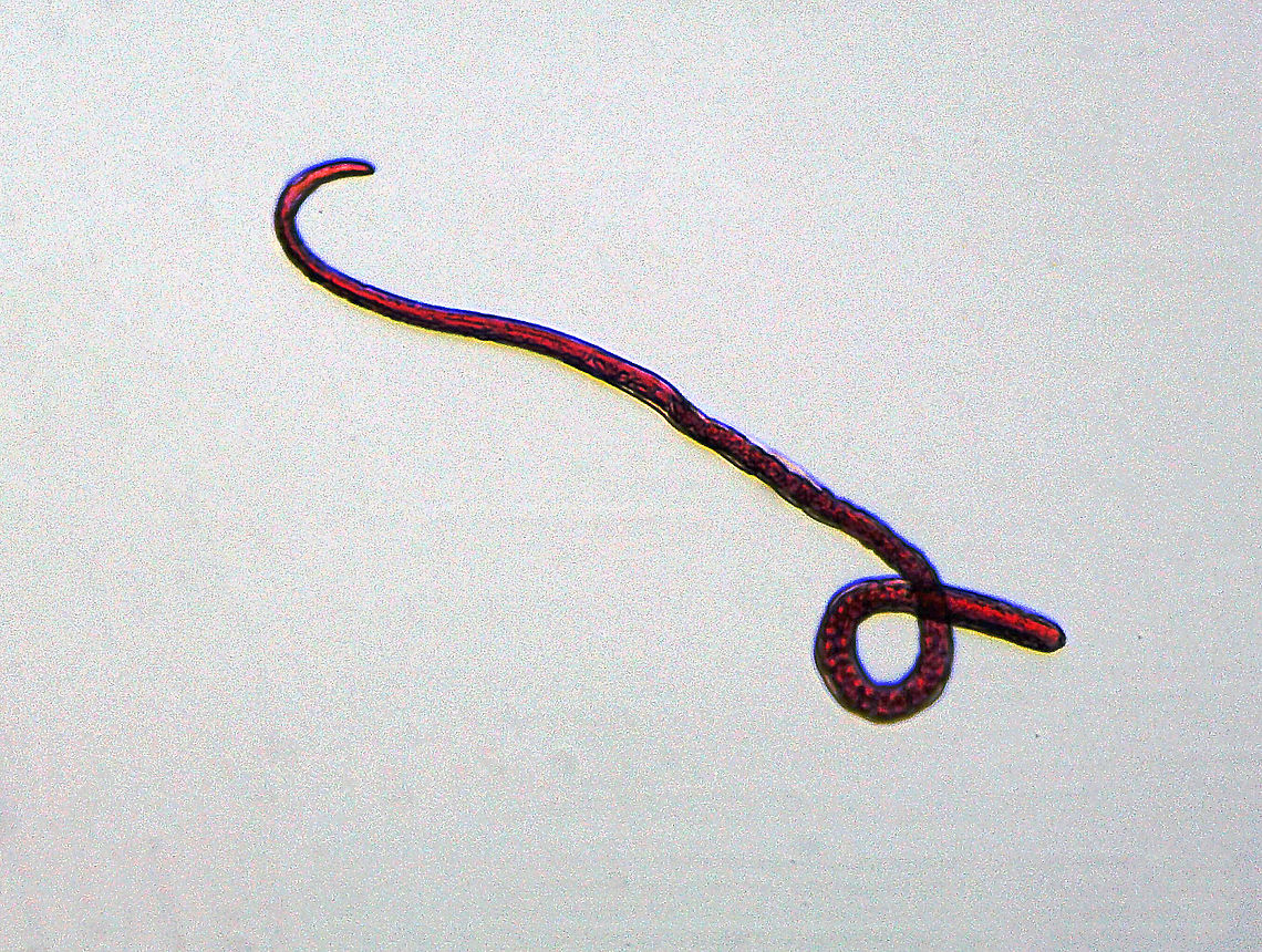 Pork Worm (Female) - Trichinella spiralis Pork worm is a parasite of rodents, pigs, bears, hyenas, and humans It causes the disease trichinosis. It is acquired when a host eats undercooked, infected meat. Usually, the infection is minor and causes diarrhea, abdominal pain, and vomiting. But, complications can occur.<br />
<br />
*Microscope whole mount slide<br />
<figure class="photo"><a href="https://www.jungledragon.com/image/114306/pork_worm_female_-_trichinella_spiralis.html" title="Pork Worm (Female) - Trichinella spiralis"><img src="https://s3.amazonaws.com/media.jungledragon.com/images/3232/114306_thumb.jpg?AWSAccessKeyId=05GMT0V3GWVNE7GGM1R2&Expires=1767225610&Signature=bd4QxTMhEmFtVvbvMiVtDTx2JDM%3D" width="200" height="154" alt="Pork Worm (Female) - Trichinella spiralis Pork worm is a parasite of rodents, pigs, bears, hyenas, and humans It causes the disease trichinosis. It is acquired when a host eats undercooked, infected meat. Usually, the infection is minor and causes diarrhea, abdominal pain, and vomiting. But, complications can occur.<br />
<br />
*Microscope whole mount slide<br />
https://www.jungledragon.com/image/114307/pork_worm_female_-_trichinella_spiralis.html Geotagged,Trichinella,Trichinella spiralis,United States,Winter,nematode,pork worm" /></a></figure> Geotagged,Trichinella,Trichinella spiralis,United States,Winter,nematode,pork worm,trichinosis
