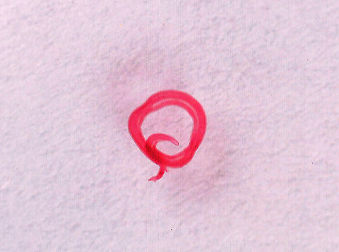 Blood Fluke (Male) - Schistosoma mansoni Schistosoma mansoni is a water-borne parasite in humans. It is the most prevalent parasite in humans and causes intestinal schistosomiasis, which infects over 250 million people worldwide. It is considered to be a Neglected Tropical Disease. Treatment is inexpensive and only costs about US$0.20 per child per year! And yet, treatment is still hard to obtain in poor, developing countries.

The disease is spread by contact with fresh water contaminated with the parasites, which are released from infected snails. Symptoms include abdominal pain and diarrhea . Long-term, it can cause liver damage, kidney failure, infertility, or bladder cancer. Children are particularly vulnerable because they play in water, which is often contaminated with infected snails.

*Whole mount slide; this photo was taken at low magnification, just so that I could get a shot of the entire worm.
https://www.jungledragon.com/image/114415/blood_fluke_male_-_schistosoma_mansoni.html
https://www.jungledragon.com/image/114414/blood_fluke_male_-_schistosoma_mansoni.html Geotagged,Schistosoma mansoni,United States