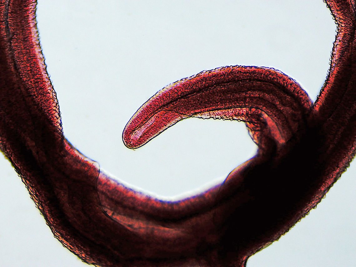 Blood Fluke (Male) - Schistosoma mansoni Schistosoma mansoni is a water-borne parasite in humans. It is the most prevalent parasite in humans and causes intestinal schistosomiasis, which infects over 250 million people worldwide. It is considered to be a Neglected Tropical Disease. Treatment is inexpensive and only costs about US$0.20 per child per year! And yet, treatment is still hard to obtain in poor, developing countries.<br />
<br />
The disease is spread by contact with fresh water contaminated with the parasites, which are released from infected snails. Symptoms include abdominal pain and diarrhea . Long-term, it can cause liver damage, kidney failure, infertility, or bladder cancer. Children are particularly vulnerable because they play in water, which is often contaminated with infected snails.<br />
<br />
*Whole mount slide<br />
<figure class="photo"><a href="https://www.jungledragon.com/image/114415/blood_fluke_male_-_schistosoma_mansoni.html" title="Blood Fluke (Male) - Schistosoma mansoni"><img src="https://s3.amazonaws.com/media.jungledragon.com/images/3232/114415_thumb.jpg?AWSAccessKeyId=05GMT0V3GWVNE7GGM1R2&Expires=1759968010&Signature=EYorIBqi7JNNtsN9bffA3E366h4%3D" width="200" height="150" alt="Blood Fluke (Male) - Schistosoma mansoni Schistosoma mansoni is a water-borne parasite in humans. It is the most prevalent parasite in humans and causes intestinal schistosomiasis, which infects over 250 million people worldwide. It is considered to be a Neglected Tropical Disease. Treatment is inexpensive and only costs about US$0.20 per child per year! And yet, treatment is still hard to obtain in poor, developing countries.<br />
<br />
The disease is spread by contact with fresh water contaminated with the parasites, which are released from infected snails.  Symptoms include abdominal pain and diarrhea . Long-term, it can cause liver damage, kidney failure, infertility, or bladder cancer. Children are particularly vulnerable because they play in water, which is often contaminated with infected snails.<br />
<br />
*Whole mount slide<br />
https://www.jungledragon.com/image/114414/blood_fluke_male_-_schistosoma_mansoni.html<br />
https://www.jungledragon.com/image/114413/blood_fluke_male_-_schistosoma_mansoni.html Geotagged,Schistosoma,Schistosoma mansoni,United States,Winter,blood fluke,schistosomiasis,snail fever" /></a></figure><br />
<figure class="photo"><a href="https://www.jungledragon.com/image/114413/blood_fluke_male_-_schistosoma_mansoni.html" title="Blood Fluke (Male) - Schistosoma mansoni"><img src="https://s3.amazonaws.com/media.jungledragon.com/images/3232/114413_thumb.jpg?AWSAccessKeyId=05GMT0V3GWVNE7GGM1R2&Expires=1759968010&Signature=3aGWSrRC1FYyYkDUaw1vSITB6p4%3D" width="200" height="150" alt="Blood Fluke (Male) - Schistosoma mansoni Schistosoma mansoni is a water-borne parasite in humans. It is the most prevalent parasite in humans and causes intestinal schistosomiasis, which infects over 250 million people worldwide. It is considered to be a Neglected Tropical Disease. Treatment is inexpensive and only costs about US$0.20 per child per year! And yet, treatment is still hard to obtain in poor, developing countries.<br />
<br />
The disease is spread by contact with fresh water contaminated with the parasites, which are released from infected snails. Symptoms include abdominal pain and diarrhea . Long-term, it can cause liver damage, kidney failure, infertility, or bladder cancer. Children are particularly vulnerable because they play in water, which is often contaminated with infected snails.<br />
<br />
*Whole mount slide; this photo was taken at low magnification, just so that I could get a shot of the entire worm.<br />
https://www.jungledragon.com/image/114415/blood_fluke_male_-_schistosoma_mansoni.html<br />
https://www.jungledragon.com/image/114414/blood_fluke_male_-_schistosoma_mansoni.html Geotagged,Schistosoma mansoni,United States" /></a></figure> Geotagged,Schistosoma mansoni,United States,Winter
