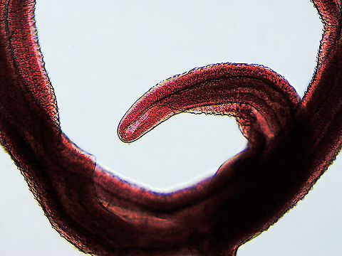 Blood Fluke (Male) - Schistosoma mansoni Schistosoma mansoni is a water-borne parasite in humans. It is the most prevalent parasite in humans and causes intestinal schistosomiasis, which infects over 250 million people worldwide. It is considered to be a Neglected Tropical Disease. Treatment is inexpensive and only costs about US$0.20 per child per year! And yet, treatment is still hard to obtain in poor, developing countries.

The disease is spread by contact with fresh water contaminated with the parasites, which are released from infected snails. Symptoms include abdominal pain and diarrhea . Long-term, it can cause liver damage, kidney failure, infertility, or bladder cancer. Children are particularly vulnerable because they play in water, which is often contaminated with infected snails.

*Whole mount slide
https://www.jungledragon.com/image/114415/blood_fluke_male_-_schistosoma_mansoni.html
https://www.jungledragon.com/image/114413/blood_fluke_male_-_schistosoma_mansoni.html Geotagged,Schistosoma mansoni,United States,Winter