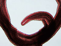 Blood Fluke (Male) - Schistosoma mansoni Schistosoma mansoni is a water-borne parasite in humans. It is the most prevalent parasite in humans and causes intestinal schistosomiasis, which infects over 250 million people worldwide. It is considered to be a Neglected Tropical Disease. Treatment is inexpensive and only costs about US$0.20 per child per year! And yet, treatment is still hard to obtain in poor, developing countries.<br />
<br />
The disease is spread by contact with fresh water contaminated with the parasites, which are released from infected snails. Symptoms include abdominal pain and diarrhea . Long-term, it can cause liver damage, kidney failure, infertility, or bladder cancer. Children are particularly vulnerable because they play in water, which is often contaminated with infected snails.<br />
<br />
*Whole mount slide<br />
https://www.jungledragon.com/image/114415/blood_fluke_male_-_schistosoma_mansoni.html<br />
https://www.jungledragon.com/image/114413/blood_fluke_male_-_schistosoma_mansoni.html Geotagged,Schistosoma mansoni,United States,Winter