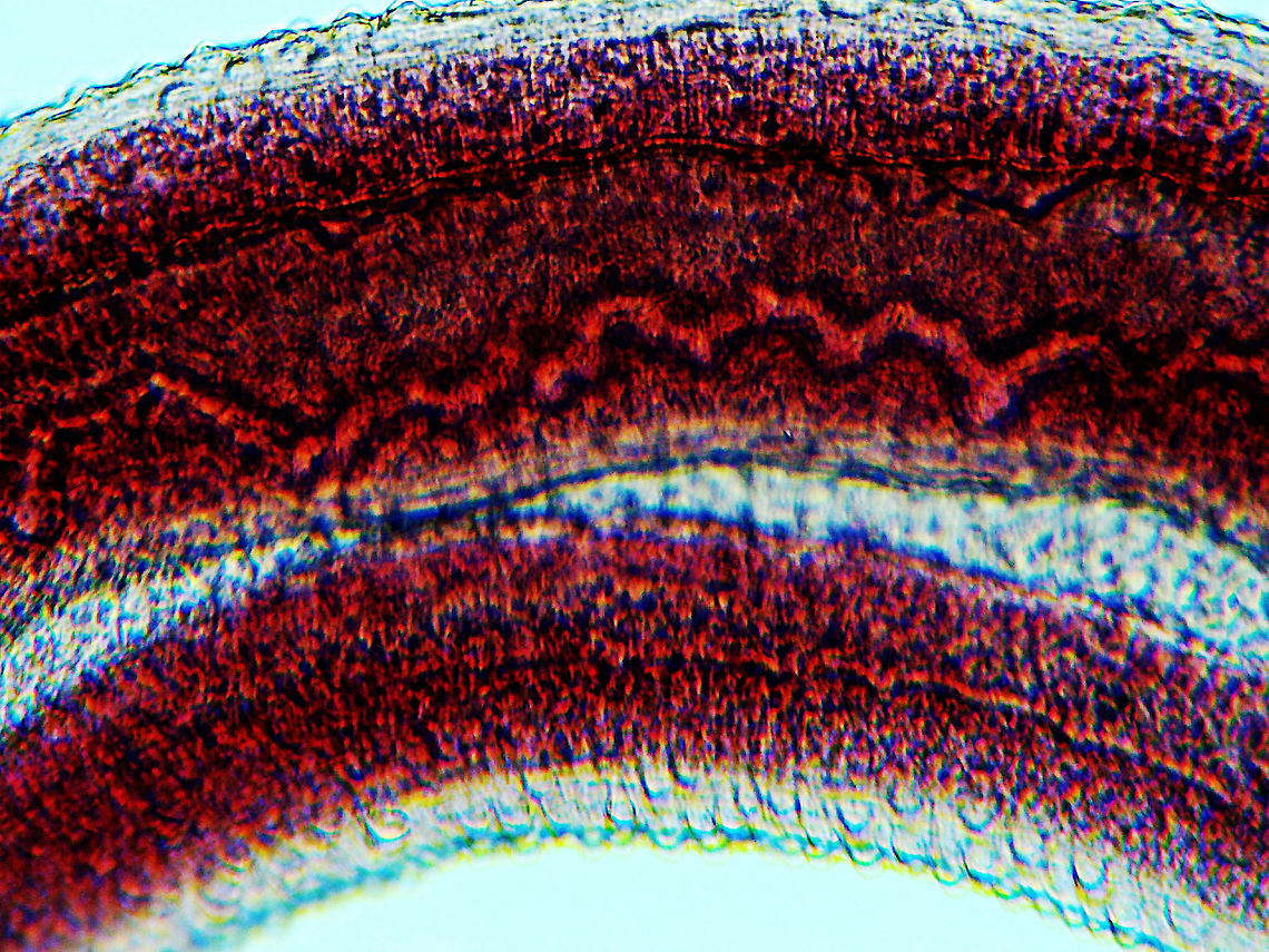 Blood Fluke (Male) - Schistosoma mansoni Schistosoma mansoni is a water-borne parasite in humans. It is the most prevalent parasite in humans and causes intestinal schistosomiasis, which infects over 250 million people worldwide. It is considered to be a Neglected Tropical Disease. Treatment is inexpensive and only costs about US$0.20 per child per year! And yet, treatment is still hard to obtain in poor, developing countries.<br />
<br />
The disease is spread by contact with fresh water contaminated with the parasites, which are released from infected snails.  Symptoms include abdominal pain and diarrhea . Long-term, it can cause liver damage, kidney failure, infertility, or bladder cancer. Children are particularly vulnerable because they play in water, which is often contaminated with infected snails.<br />
<br />
*Whole mount slide<br />
<figure class="photo"><a href="https://www.jungledragon.com/image/114414/blood_fluke_male_-_schistosoma_mansoni.html" title="Blood Fluke (Male) - Schistosoma mansoni"><img src="https://s3.amazonaws.com/media.jungledragon.com/images/3232/114414_thumb.jpg?AWSAccessKeyId=05GMT0V3GWVNE7GGM1R2&Expires=1759968010&Signature=duOdrtbLQ24OMGHpeh0vDvTgV3U%3D" width="200" height="150" alt="Blood Fluke (Male) - Schistosoma mansoni Schistosoma mansoni is a water-borne parasite in humans. It is the most prevalent parasite in humans and causes intestinal schistosomiasis, which infects over 250 million people worldwide. It is considered to be a Neglected Tropical Disease. Treatment is inexpensive and only costs about US$0.20 per child per year! And yet, treatment is still hard to obtain in poor, developing countries.<br />
<br />
The disease is spread by contact with fresh water contaminated with the parasites, which are released from infected snails. Symptoms include abdominal pain and diarrhea . Long-term, it can cause liver damage, kidney failure, infertility, or bladder cancer. Children are particularly vulnerable because they play in water, which is often contaminated with infected snails.<br />
<br />
*Whole mount slide<br />
https://www.jungledragon.com/image/114415/blood_fluke_male_-_schistosoma_mansoni.html<br />
https://www.jungledragon.com/image/114413/blood_fluke_male_-_schistosoma_mansoni.html Geotagged,Schistosoma mansoni,United States,Winter" /></a></figure><br />
<figure class="photo"><a href="https://www.jungledragon.com/image/114413/blood_fluke_male_-_schistosoma_mansoni.html" title="Blood Fluke (Male) - Schistosoma mansoni"><img src="https://s3.amazonaws.com/media.jungledragon.com/images/3232/114413_thumb.jpg?AWSAccessKeyId=05GMT0V3GWVNE7GGM1R2&Expires=1759968010&Signature=3aGWSrRC1FYyYkDUaw1vSITB6p4%3D" width="200" height="150" alt="Blood Fluke (Male) - Schistosoma mansoni Schistosoma mansoni is a water-borne parasite in humans. It is the most prevalent parasite in humans and causes intestinal schistosomiasis, which infects over 250 million people worldwide. It is considered to be a Neglected Tropical Disease. Treatment is inexpensive and only costs about US$0.20 per child per year! And yet, treatment is still hard to obtain in poor, developing countries.<br />
<br />
The disease is spread by contact with fresh water contaminated with the parasites, which are released from infected snails. Symptoms include abdominal pain and diarrhea . Long-term, it can cause liver damage, kidney failure, infertility, or bladder cancer. Children are particularly vulnerable because they play in water, which is often contaminated with infected snails.<br />
<br />
*Whole mount slide; this photo was taken at low magnification, just so that I could get a shot of the entire worm.<br />
https://www.jungledragon.com/image/114415/blood_fluke_male_-_schistosoma_mansoni.html<br />
https://www.jungledragon.com/image/114414/blood_fluke_male_-_schistosoma_mansoni.html Geotagged,Schistosoma mansoni,United States" /></a></figure> Geotagged,Schistosoma,Schistosoma mansoni,United States,Winter,blood fluke,schistosomiasis,snail fever