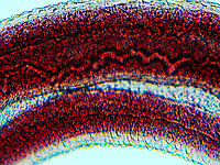 Blood Fluke (Male) - Schistosoma mansoni Schistosoma mansoni is a water-borne parasite in humans. It is the most prevalent parasite in humans and causes intestinal schistosomiasis, which infects over 250 million people worldwide. It is considered to be a Neglected Tropical Disease. Treatment is inexpensive and only costs about US$0.20 per child per year! And yet, treatment is still hard to obtain in poor, developing countries.<br />
<br />
The disease is spread by contact with fresh water contaminated with the parasites, which are released from infected snails.  Symptoms include abdominal pain and diarrhea . Long-term, it can cause liver damage, kidney failure, infertility, or bladder cancer. Children are particularly vulnerable because they play in water, which is often contaminated with infected snails.<br />
<br />
*Whole mount slide<br />
https://www.jungledragon.com/image/114414/blood_fluke_male_-_schistosoma_mansoni.html<br />
https://www.jungledragon.com/image/114413/blood_fluke_male_-_schistosoma_mansoni.html Geotagged,Schistosoma,Schistosoma mansoni,United States,Winter,blood fluke,schistosomiasis,snail fever
