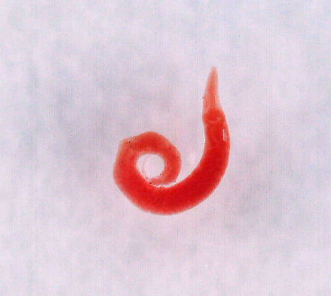 Pinworm - Enterobius vermicularis This is a gross one! Pinworms are intestinal parasites of humans. They cause enterobiasis, the primary symptom of which is anal itching. It's most common in children.  

The life cycle goes like this:  
Infection occurs through self-inoculation (transferring the parasite to the mouth with hands that have scratched the anus) or through exposure to eggs in the environment (contaminated surfaces, clothes, sheets, etc.). Following ingestion, the larvae hatch in the small intestine and then the adults establish themselves in the colon. At full maturity, adult females migrate (nocturnally) outside the anus and lay eggs while crawling on the skin of the perianal area. This causes itching. The person itches their butt, contaminates surfaces or ingests the eggs, and then the cycle begins again.

*Whole mount slide Enterobius,Enterobius vermicularis,Geotagged,Pinworm,United States,enterobiasis,nematode,parasite,parasitic worm,roundworm,threadworm