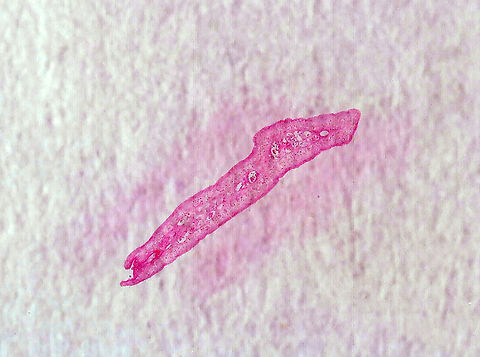 Beef Tapeworm - Taenia saginata The beef tapeworm is a zoonotic parasite in which cattle are the intermediate hosts (where larval development occurs) and humans are definitive hosts (harboring the adult worms).

This tapeworm causes taeniasis in humans, which is often asymptomatic. But, a heavy infection can cause weight loss, abdominal pain, diarrhea, nausea, chronic indigestion, etc. Intestinal obstruction is a severe consequence of infection. Most infections clear up in 2-3 years without treatment.

*Cross-section microscope slide
https://www.jungledragon.com/image/115023/beef_tapeworm_-_taenia_saginata.html Geotagged,Taenia,Taenia saginata,United States,beef tapeworm,intestinal parasite,taeniasis,tapeworm,zoonosis