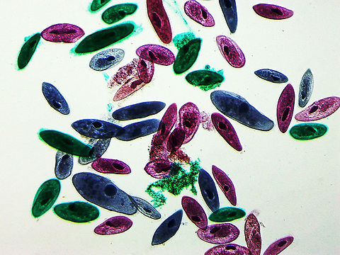 Paramecium caudatum Aren't they gorgeous!?

Paramecium caudatum are very common unicellular protists and can be found in marine, brackish, and freshwater environments. They feed on bacteria and small eukaryotic cells, such as yeast and algae.  

*Whole mount slide; they were ~200-300 μm
https://www.jungledragon.com/image/115022/paramecium_caudatum.html Chromista,Geotagged,Paramecium,Paramecium caudatum,United States,Winter,protist,protista,protozoa
