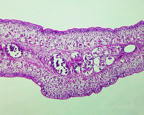 Beef Tapeworm - Taenia saginata The beef tapeworm is a zoonotic parasite in which cattle are the intermediate hosts (where larval development occurs) and humans are definitive hosts (harboring the adult worms).

This tapeworm causes taeniasis in humans, which is often asymptomatic. But, a heavy infection can cause weight loss, abdominal pain, diarrhea, nausea, chronic indigestion, etc. Intestinal obstruction is a severe consequence of infection. Most infections clear up in 2-3 years without treatment.

*Cross-section microscope slide
https://www.jungledragon.com/image/115020/beef_tapeworm_-_taenia_saginata.html Beef Tapeworm,Geotagged,Taenia saginata,United States,Winter