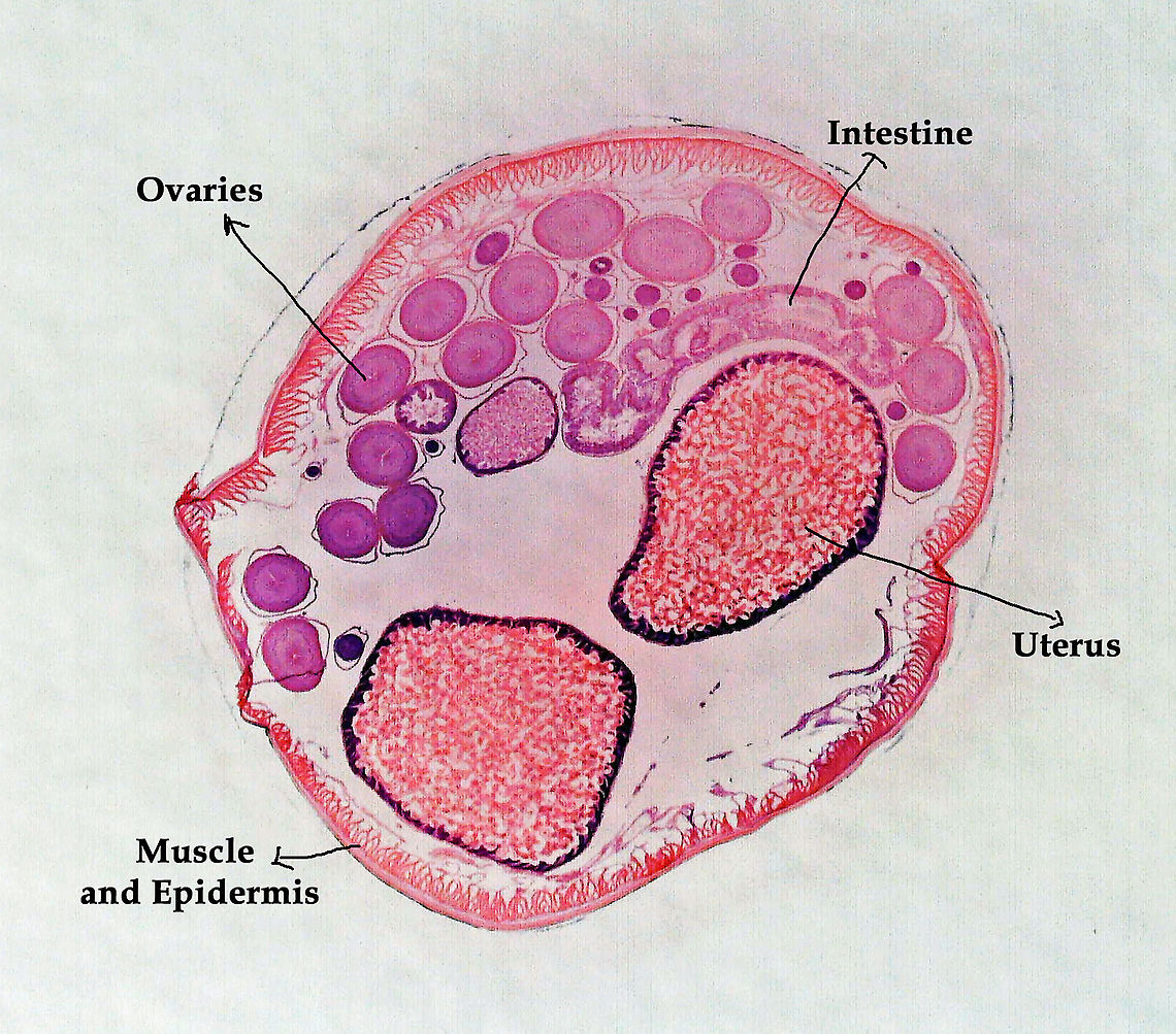 Roundworm (Female) with Labels - Ascaris lumbricoides Ascaris lumbricoides is a large roundworm that infects humans. It grows to 35 cm (14 in)!! <br />
<br />
It causes ascariasis, which is a Neglected Tropical Disease (NTG). Worldwide, approximately 1 billion people are infected with this nematode, with infection being more prevalent in tropical areas where sanitation is poor.  It infects humans via the fecal-oral route...eggs are shed in feces and then get ingested. Hygiene is crucial to preventing the spread of this disease because it is one of the most difficult pathogens in the world to kill (the eggs can survive several years!).<br />
<br />
*Microscope slide; cross-section<br />
<figure class="photo"><a href="https://www.jungledragon.com/image/118183/roundworm_female_with_labels_-_ascaris_lumbricoides.html" title="Roundworm (Female) with Labels - Ascaris lumbricoides"><img src="https://s3.amazonaws.com/media.jungledragon.com/images/3232/118183_thumb.jpg?AWSAccessKeyId=05GMT0V3GWVNE7GGM1R2&Expires=1767225610&Signature=f2DA1FWy1z1t%2FbBTb0ul6P4noOQ%3D" width="200" height="176" alt="Roundworm (Female) with Labels - Ascaris lumbricoides Ascaris lumbricoides is a large roundworm that infects humans. It grows to 35 cm (14 in)!! <br />
<br />
It causes ascariasis, which is a Neglected Tropical Disease (NTG). Worldwide, approximately 1 billion people are infected with this nematode, with infection being more prevalent in tropical areas where sanitation is poor.  It infects humans via the fecal-oral route...eggs are shed in feces and then get ingested. Hygiene is crucial to preventing the spread of this disease because it is one of the most difficult pathogens in the world to kill (the eggs can survive several years!).<br />
<br />
*Microscope slide; cross-section<br />
https://www.jungledragon.com/image/118183/roundworm_female_with_labels_-_ascaris_lumbricoides.html<br />
https://www.jungledragon.com/image/118184/roundworm_female_-_ascaris_lumbricoides.html<br />
https://www.jungledragon.com/image/118185/roundworm_uterus_cross-section_female_-_ascaris_lumbricoides.html<br />
https://www.jungledragon.com/image/118187/roundworm_ovary_cross-section_female_-_ascaris_lumbricoides.html<br />
https://www.jungledragon.com/image/118186/roundworm_ovaries_cross-section_female_-_ascaris_lumbricoides.html Ascaris,Ascaris lumbricoides,Nematoda,ascariasis,helminthiasis,nematode,roundworm" /></a></figure><br />
<figure class="photo"><a href="https://www.jungledragon.com/image/118184/roundworm_female_-_ascaris_lumbricoides.html" title="Roundworm (Female) - Ascaris lumbricoides"><img src="https://s3.amazonaws.com/media.jungledragon.com/images/3232/118184_thumb.jpg?AWSAccessKeyId=05GMT0V3GWVNE7GGM1R2&Expires=1767225610&Signature=urdbrPo26FcfuAcMj1dkqs7G%2Fdw%3D" width="200" height="176" alt="Roundworm (Female) - Ascaris lumbricoides Ascaris lumbricoides is a large roundworm that infects humans. It grows to 35 cm (14 in)!!<br />
<br />
It causes ascariasis, which is a Neglected Tropical Disease (NTG). Worldwide, approximately 1 billion people are infected with this nematode, with infection being more prevalent in tropical areas where sanitation is poor. It infects humans via the fecal-oral route...eggs are shed in feces and then get ingested. Hygiene is crucial to preventing the spread of this disease because it is one of the most difficult pathogens in the world to kill (the eggs can survive several years!).<br />
<br />
*Microscope slide; cross-section<br />
https://www.jungledragon.com/image/118183/roundworm_female_with_labels_-_ascaris_lumbricoides.html<br />
https://www.jungledragon.com/image/118184/roundworm_female_-_ascaris_lumbricoides.html<br />
https://www.jungledragon.com/image/118185/roundworm_uterus_cross-section_female_-_ascaris_lumbricoides.html<br />
https://www.jungledragon.com/image/118187/roundworm_ovary_cross-section_female_-_ascaris_lumbricoides.html<br />
https://www.jungledragon.com/image/118186/roundworm_ovaries_cross-section_female_-_ascaris_lumbricoides.html Ascaris lumbricoides" /></a></figure><br />
<figure class="photo"><a href="https://www.jungledragon.com/image/118185/roundworm_uterus_cross-section_female_-_ascaris_lumbricoides.html" title="Roundworm Uterus Cross-section (Female) - Ascaris lumbricoides"><img src="https://s3.amazonaws.com/media.jungledragon.com/images/3232/118185_thumb.jpg?AWSAccessKeyId=05GMT0V3GWVNE7GGM1R2&Expires=1767225610&Signature=v3TEnIYeeKzSgLZJqHnqEFwv4Xw%3D" width="200" height="150" alt="Roundworm Uterus Cross-section (Female) - Ascaris lumbricoides Ascaris lumbricoides is a large roundworm that infects humans. It grows to 35 cm (14 in)!!<br />
<br />
It causes ascariasis, which is a Neglected Tropical Disease (NTG). Worldwide, approximately 1 billion people are infected with this nematode, with infection being more prevalent in tropical areas where sanitation is poor. It infects humans via the fecal-oral route...eggs are shed in feces and then get ingested. Hygiene is crucial to preventing the spread of this disease because it is one of the most difficult pathogens in the world to kill (the eggs can survive several years!).<br />
<br />
*Microscope slide; cross-sectionhttps://www.jungledragon.com/image/118183/roundworm_female_with_labels_-_ascaris_lumbricoides.html<br />
https://www.jungledragon.com/image/118184/roundworm_female_-_ascaris_lumbricoides.html<br />
https://www.jungledragon.com/image/118185/roundworm_uterus_cross-section_female_-_ascaris_lumbricoides.html<br />
https://www.jungledragon.com/image/118187/roundworm_ovary_cross-section_female_-_ascaris_lumbricoides.html<br />
https://www.jungledragon.com/image/118186/roundworm_ovaries_cross-section_female_-_ascaris_lumbricoides.html Ascaris lumbricoides,Geotagged,Summer" /></a></figure><br />
<figure class="photo"><a href="https://www.jungledragon.com/image/118187/roundworm_ovary_cross-section_female_-_ascaris_lumbricoides.html" title="Roundworm Ovary Cross-section (Female) - Ascaris lumbricoides"><img src="https://s3.amazonaws.com/media.jungledragon.com/images/3232/118187_thumb.jpg?AWSAccessKeyId=05GMT0V3GWVNE7GGM1R2&Expires=1767225610&Signature=fEEKCVWb2BZUHBX54gJeVdY%2FWDE%3D" width="200" height="150" alt="Roundworm Ovary Cross-section (Female) - Ascaris lumbricoides Ascaris lumbricoides is a large roundworm that infects humans. It grows to 35 cm (14 in)!!<br />
<br />
It causes ascariasis, which is a Neglected Tropical Disease (NTG). Worldwide, approximately 1 billion people are infected with this nematode, with infection being more prevalent in tropical areas where sanitation is poor. It infects humans via the fecal-oral route...eggs are shed in feces and then get ingested. Hygiene is crucial to preventing the spread of this disease because it is one of the most difficult pathogens in the world to kill (the eggs can survive several years!).<br />
<br />
*Microscope slide; cross-section<br />
https://www.jungledragon.com/image/118183/roundworm_female_with_labels_-_ascaris_lumbricoides.html<br />
https://www.jungledragon.com/image/118184/roundworm_female_-_ascaris_lumbricoides.html<br />
https://www.jungledragon.com/image/118185/roundworm_uterus_cross-section_female_-_ascaris_lumbricoides.html<br />
https://www.jungledragon.com/image/118187/roundworm_ovary_cross-section_female_-_ascaris_lumbricoides.html<br />
https://www.jungledragon.com/image/118186/roundworm_ovaries_cross-section_female_-_ascaris_lumbricoides.html Ascaris lumbricoides,Geotagged,Summer" /></a></figure><br />
<figure class="photo"><a href="https://www.jungledragon.com/image/118186/roundworm_ovaries_cross-section_female_-_ascaris_lumbricoides.html" title="Roundworm Ovaries Cross-section (Female) - Ascaris lumbricoides"><img src="https://s3.amazonaws.com/media.jungledragon.com/images/3232/118186_thumb.jpg?AWSAccessKeyId=05GMT0V3GWVNE7GGM1R2&Expires=1767225610&Signature=c27yeerOnVtl37x40jUbkRsb68M%3D" width="200" height="150" alt="Roundworm Ovaries Cross-section (Female) - Ascaris lumbricoides Ascaris lumbricoides is a large roundworm that infects humans. It grows to 35 cm (14 in)!!<br />
<br />
It causes ascariasis, which is a Neglected Tropical Disease (NTG). Worldwide, approximately 1 billion people are infected with this nematode, with infection being more prevalent in tropical areas where sanitation is poor. It infects humans via the fecal-oral route...eggs are shed in feces and then get ingested. Hygiene is crucial to preventing the spread of this disease because it is one of the most difficult pathogens in the world to kill (the eggs can survive several years!).<br />
<br />
*Microscope slide; cross-section<br />
https://www.jungledragon.com/image/118183/roundworm_female_with_labels_-_ascaris_lumbricoides.html<br />
https://www.jungledragon.com/image/118184/roundworm_female_-_ascaris_lumbricoides.html<br />
https://www.jungledragon.com/image/118185/roundworm_uterus_cross-section_female_-_ascaris_lumbricoides.html<br />
https://www.jungledragon.com/image/118187/roundworm_ovary_cross-section_female_-_ascaris_lumbricoides.html<br />
https://www.jungledragon.com/image/118186/roundworm_ovaries_cross-section_female_-_ascaris_lumbricoides.html Ascaris lumbricoides" /></a></figure> Ascaris,Ascaris lumbricoides,Nematoda,ascariasis,helminthiasis,nematode,roundworm