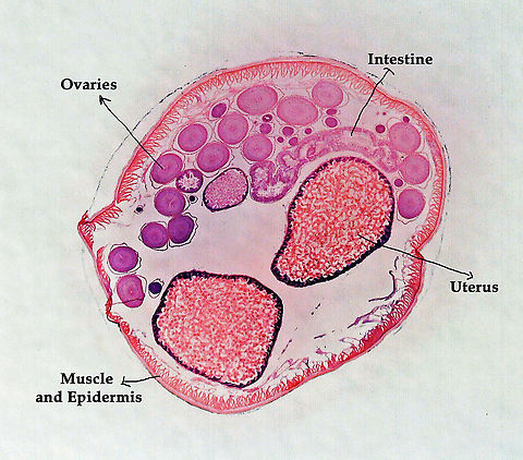 Roundworm (Female) with Labels - Ascaris lumbricoides Ascaris lumbricoides is a large roundworm that infects humans. It grows to 35 cm (14 in)!! 

It causes ascariasis, which is a Neglected Tropical Disease (NTG). Worldwide, approximately 1 billion people are infected with this nematode, with infection being more prevalent in tropical areas where sanitation is poor.  It infects humans via the fecal-oral route...eggs are shed in feces and then get ingested. Hygiene is crucial to preventing the spread of this disease because it is one of the most difficult pathogens in the world to kill (the eggs can survive several years!).

*Microscope slide; cross-section
https://www.jungledragon.com/image/118183/roundworm_female_with_labels_-_ascaris_lumbricoides.html
https://www.jungledragon.com/image/118184/roundworm_female_-_ascaris_lumbricoides.html
https://www.jungledragon.com/image/118185/roundworm_uterus_cross-section_female_-_ascaris_lumbricoides.html
https://www.jungledragon.com/image/118187/roundworm_ovary_cross-section_female_-_ascaris_lumbricoides.html
https://www.jungledragon.com/image/118186/roundworm_ovaries_cross-section_female_-_ascaris_lumbricoides.html Ascaris,Ascaris lumbricoides,Nematoda,ascariasis,helminthiasis,nematode,roundworm