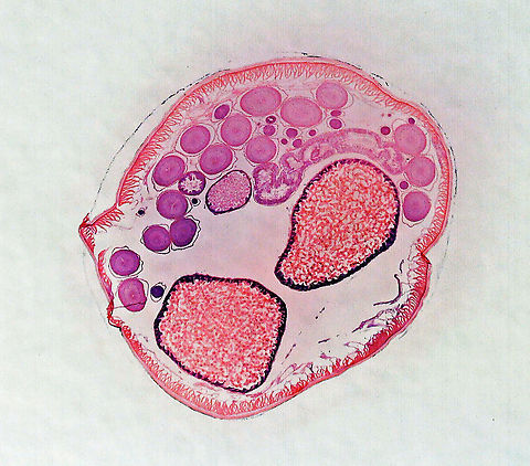 Roundworm (Female) - Ascaris lumbricoides Ascaris lumbricoides is a large roundworm that infects humans. It grows to 35 cm (14 in)!!

It causes ascariasis, which is a Neglected Tropical Disease (NTG). Worldwide, approximately 1 billion people are infected with this nematode, with infection being more prevalent in tropical areas where sanitation is poor. It infects humans via the fecal-oral route...eggs are shed in feces and then get ingested. Hygiene is crucial to preventing the spread of this disease because it is one of the most difficult pathogens in the world to kill (the eggs can survive several years!).

*Microscope slide; cross-section
https://www.jungledragon.com/image/118183/roundworm_female_with_labels_-_ascaris_lumbricoides.html
https://www.jungledragon.com/image/118184/roundworm_female_-_ascaris_lumbricoides.html
https://www.jungledragon.com/image/118185/roundworm_uterus_cross-section_female_-_ascaris_lumbricoides.html
https://www.jungledragon.com/image/118187/roundworm_ovary_cross-section_female_-_ascaris_lumbricoides.html
https://www.jungledragon.com/image/118186/roundworm_ovaries_cross-section_female_-_ascaris_lumbricoides.html Ascaris lumbricoides