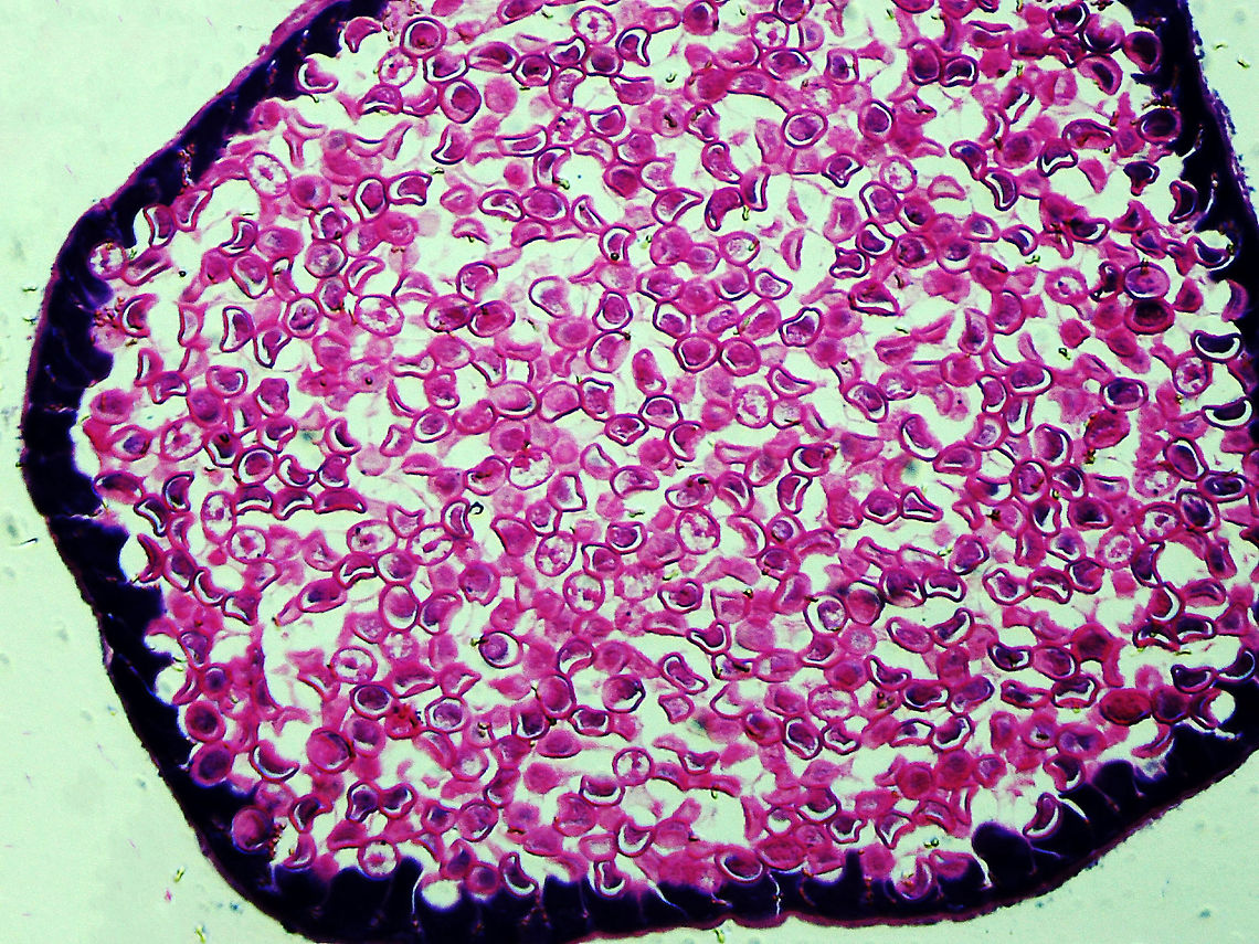 Roundworm Uterus Cross-section (Female) - Ascaris lumbricoides Ascaris lumbricoides is a large roundworm that infects humans. It grows to 35 cm (14 in)!!<br />
<br />
It causes ascariasis, which is a Neglected Tropical Disease (NTG). Worldwide, approximately 1 billion people are infected with this nematode, with infection being more prevalent in tropical areas where sanitation is poor. It infects humans via the fecal-oral route...eggs are shed in feces and then get ingested. Hygiene is crucial to preventing the spread of this disease because it is one of the most difficult pathogens in the world to kill (the eggs can survive several years!).<br />
<br />
*Microscope slide; cross-sectionhttps://www.jungledragon.com/image/118183/roundworm_female_with_labels_-_ascaris_lumbricoides.html<br />
<figure class="photo"><a href="https://www.jungledragon.com/image/118184/roundworm_female_-_ascaris_lumbricoides.html" title="Roundworm (Female) - Ascaris lumbricoides"><img src="https://s3.amazonaws.com/media.jungledragon.com/images/3232/118184_thumb.jpg?AWSAccessKeyId=05GMT0V3GWVNE7GGM1R2&Expires=1767225610&Signature=urdbrPo26FcfuAcMj1dkqs7G%2Fdw%3D" width="200" height="176" alt="Roundworm (Female) - Ascaris lumbricoides Ascaris lumbricoides is a large roundworm that infects humans. It grows to 35 cm (14 in)!!<br />
<br />
It causes ascariasis, which is a Neglected Tropical Disease (NTG). Worldwide, approximately 1 billion people are infected with this nematode, with infection being more prevalent in tropical areas where sanitation is poor. It infects humans via the fecal-oral route...eggs are shed in feces and then get ingested. Hygiene is crucial to preventing the spread of this disease because it is one of the most difficult pathogens in the world to kill (the eggs can survive several years!).<br />
<br />
*Microscope slide; cross-section<br />
https://www.jungledragon.com/image/118183/roundworm_female_with_labels_-_ascaris_lumbricoides.html<br />
https://www.jungledragon.com/image/118184/roundworm_female_-_ascaris_lumbricoides.html<br />
https://www.jungledragon.com/image/118185/roundworm_uterus_cross-section_female_-_ascaris_lumbricoides.html<br />
https://www.jungledragon.com/image/118187/roundworm_ovary_cross-section_female_-_ascaris_lumbricoides.html<br />
https://www.jungledragon.com/image/118186/roundworm_ovaries_cross-section_female_-_ascaris_lumbricoides.html Ascaris lumbricoides" /></a></figure><br />
<figure class="photo"><a href="https://www.jungledragon.com/image/118185/roundworm_uterus_cross-section_female_-_ascaris_lumbricoides.html" title="Roundworm Uterus Cross-section (Female) - Ascaris lumbricoides"><img src="https://s3.amazonaws.com/media.jungledragon.com/images/3232/118185_thumb.jpg?AWSAccessKeyId=05GMT0V3GWVNE7GGM1R2&Expires=1767225610&Signature=v3TEnIYeeKzSgLZJqHnqEFwv4Xw%3D" width="200" height="150" alt="Roundworm Uterus Cross-section (Female) - Ascaris lumbricoides Ascaris lumbricoides is a large roundworm that infects humans. It grows to 35 cm (14 in)!!<br />
<br />
It causes ascariasis, which is a Neglected Tropical Disease (NTG). Worldwide, approximately 1 billion people are infected with this nematode, with infection being more prevalent in tropical areas where sanitation is poor. It infects humans via the fecal-oral route...eggs are shed in feces and then get ingested. Hygiene is crucial to preventing the spread of this disease because it is one of the most difficult pathogens in the world to kill (the eggs can survive several years!).<br />
<br />
*Microscope slide; cross-sectionhttps://www.jungledragon.com/image/118183/roundworm_female_with_labels_-_ascaris_lumbricoides.html<br />
https://www.jungledragon.com/image/118184/roundworm_female_-_ascaris_lumbricoides.html<br />
https://www.jungledragon.com/image/118185/roundworm_uterus_cross-section_female_-_ascaris_lumbricoides.html<br />
https://www.jungledragon.com/image/118187/roundworm_ovary_cross-section_female_-_ascaris_lumbricoides.html<br />
https://www.jungledragon.com/image/118186/roundworm_ovaries_cross-section_female_-_ascaris_lumbricoides.html Ascaris lumbricoides,Geotagged,Summer" /></a></figure><br />
<figure class="photo"><a href="https://www.jungledragon.com/image/118187/roundworm_ovary_cross-section_female_-_ascaris_lumbricoides.html" title="Roundworm Ovary Cross-section (Female) - Ascaris lumbricoides"><img src="https://s3.amazonaws.com/media.jungledragon.com/images/3232/118187_thumb.jpg?AWSAccessKeyId=05GMT0V3GWVNE7GGM1R2&Expires=1767225610&Signature=fEEKCVWb2BZUHBX54gJeVdY%2FWDE%3D" width="200" height="150" alt="Roundworm Ovary Cross-section (Female) - Ascaris lumbricoides Ascaris lumbricoides is a large roundworm that infects humans. It grows to 35 cm (14 in)!!<br />
<br />
It causes ascariasis, which is a Neglected Tropical Disease (NTG). Worldwide, approximately 1 billion people are infected with this nematode, with infection being more prevalent in tropical areas where sanitation is poor. It infects humans via the fecal-oral route...eggs are shed in feces and then get ingested. Hygiene is crucial to preventing the spread of this disease because it is one of the most difficult pathogens in the world to kill (the eggs can survive several years!).<br />
<br />
*Microscope slide; cross-section<br />
https://www.jungledragon.com/image/118183/roundworm_female_with_labels_-_ascaris_lumbricoides.html<br />
https://www.jungledragon.com/image/118184/roundworm_female_-_ascaris_lumbricoides.html<br />
https://www.jungledragon.com/image/118185/roundworm_uterus_cross-section_female_-_ascaris_lumbricoides.html<br />
https://www.jungledragon.com/image/118187/roundworm_ovary_cross-section_female_-_ascaris_lumbricoides.html<br />
https://www.jungledragon.com/image/118186/roundworm_ovaries_cross-section_female_-_ascaris_lumbricoides.html Ascaris lumbricoides,Geotagged,Summer" /></a></figure><br />
<figure class="photo"><a href="https://www.jungledragon.com/image/118186/roundworm_ovaries_cross-section_female_-_ascaris_lumbricoides.html" title="Roundworm Ovaries Cross-section (Female) - Ascaris lumbricoides"><img src="https://s3.amazonaws.com/media.jungledragon.com/images/3232/118186_thumb.jpg?AWSAccessKeyId=05GMT0V3GWVNE7GGM1R2&Expires=1767225610&Signature=c27yeerOnVtl37x40jUbkRsb68M%3D" width="200" height="150" alt="Roundworm Ovaries Cross-section (Female) - Ascaris lumbricoides Ascaris lumbricoides is a large roundworm that infects humans. It grows to 35 cm (14 in)!!<br />
<br />
It causes ascariasis, which is a Neglected Tropical Disease (NTG). Worldwide, approximately 1 billion people are infected with this nematode, with infection being more prevalent in tropical areas where sanitation is poor. It infects humans via the fecal-oral route...eggs are shed in feces and then get ingested. Hygiene is crucial to preventing the spread of this disease because it is one of the most difficult pathogens in the world to kill (the eggs can survive several years!).<br />
<br />
*Microscope slide; cross-section<br />
https://www.jungledragon.com/image/118183/roundworm_female_with_labels_-_ascaris_lumbricoides.html<br />
https://www.jungledragon.com/image/118184/roundworm_female_-_ascaris_lumbricoides.html<br />
https://www.jungledragon.com/image/118185/roundworm_uterus_cross-section_female_-_ascaris_lumbricoides.html<br />
https://www.jungledragon.com/image/118187/roundworm_ovary_cross-section_female_-_ascaris_lumbricoides.html<br />
https://www.jungledragon.com/image/118186/roundworm_ovaries_cross-section_female_-_ascaris_lumbricoides.html Ascaris lumbricoides" /></a></figure> Ascaris lumbricoides,Geotagged,Summer