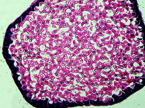 Roundworm Uterus Cross-section (Female) - Ascaris lumbricoides Ascaris lumbricoides is a large roundworm that infects humans. It grows to 35 cm (14 in)!!

It causes ascariasis, which is a Neglected Tropical Disease (NTG). Worldwide, approximately 1 billion people are infected with this nematode, with infection being more prevalent in tropical areas where sanitation is poor. It infects humans via the fecal-oral route...eggs are shed in feces and then get ingested. Hygiene is crucial to preventing the spread of this disease because it is one of the most difficult pathogens in the world to kill (the eggs can survive several years!).

*Microscope slide; cross-sectionhttps://www.jungledragon.com/image/118183/roundworm_female_with_labels_-_ascaris_lumbricoides.html
https://www.jungledragon.com/image/118184/roundworm_female_-_ascaris_lumbricoides.html
https://www.jungledragon.com/image/118185/roundworm_uterus_cross-section_female_-_ascaris_lumbricoides.html
https://www.jungledragon.com/image/118187/roundworm_ovary_cross-section_female_-_ascaris_lumbricoides.html
https://www.jungledragon.com/image/118186/roundworm_ovaries_cross-section_female_-_ascaris_lumbricoides.html Ascaris lumbricoides,Geotagged,Summer