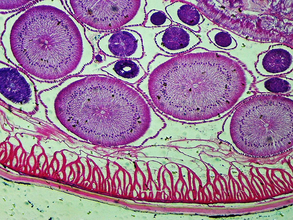 Roundworm Ovaries Cross-section (Female) - Ascaris lumbricoides Ascaris lumbricoides is a large roundworm that infects humans. It grows to 35 cm (14 in)!!<br />
<br />
It causes ascariasis, which is a Neglected Tropical Disease (NTG). Worldwide, approximately 1 billion people are infected with this nematode, with infection being more prevalent in tropical areas where sanitation is poor. It infects humans via the fecal-oral route...eggs are shed in feces and then get ingested. Hygiene is crucial to preventing the spread of this disease because it is one of the most difficult pathogens in the world to kill (the eggs can survive several years!).<br />
<br />
*Microscope slide; cross-section<br />
<figure class="photo"><a href="https://www.jungledragon.com/image/118183/roundworm_female_with_labels_-_ascaris_lumbricoides.html" title="Roundworm (Female) with Labels - Ascaris lumbricoides"><img src="https://s3.amazonaws.com/media.jungledragon.com/images/3232/118183_thumb.jpg?AWSAccessKeyId=05GMT0V3GWVNE7GGM1R2&Expires=1763596810&Signature=luegOx7%2FmBcXoaaZhR1%2BEbMO1Uk%3D" width="200" height="176" alt="Roundworm (Female) with Labels - Ascaris lumbricoides Ascaris lumbricoides is a large roundworm that infects humans. It grows to 35 cm (14 in)!! <br />
<br />
It causes ascariasis, which is a Neglected Tropical Disease (NTG). Worldwide, approximately 1 billion people are infected with this nematode, with infection being more prevalent in tropical areas where sanitation is poor. It infects humans via the fecal-oral route...eggs are shed in feces and then get ingested. Hygiene is crucial to preventing the spread of this disease because it is one of the most difficult pathogens in the world to kill (the eggs can survive several years!).<br />
<br />
*Microscope slide; cross-section<br />
https://www.jungledragon.com/image/118183/roundworm_female_with_labels_-_ascaris_lumbricoides.html<br />
https://www.jungledragon.com/image/118184/roundworm_female_-_ascaris_lumbricoides.html<br />
https://www.jungledragon.com/image/118185/roundworm_uterus_cross-section_female_-_ascaris_lumbricoides.html<br />
https://www.jungledragon.com/image/118187/roundworm_ovary_cross-section_female_-_ascaris_lumbricoides.html<br />
https://www.jungledragon.com/image/118186/roundworm_ovaries_cross-section_female_-_ascaris_lumbricoides.html Ascaris,Ascaris lumbricoides,Nematoda,ascariasis,helminthiasis,nematode,roundworm" /></a></figure><br />
<figure class="photo"><a href="https://www.jungledragon.com/image/118184/roundworm_female_-_ascaris_lumbricoides.html" title="Roundworm (Female) - Ascaris lumbricoides"><img src="https://s3.amazonaws.com/media.jungledragon.com/images/3232/118184_thumb.jpg?AWSAccessKeyId=05GMT0V3GWVNE7GGM1R2&Expires=1763596810&Signature=YqW3tnV7Szfql5Ygjtekoqo2%2Ff4%3D" width="200" height="176" alt="Roundworm (Female) - Ascaris lumbricoides Ascaris lumbricoides is a large roundworm that infects humans. It grows to 35 cm (14 in)!!<br />
<br />
It causes ascariasis, which is a Neglected Tropical Disease (NTG). Worldwide, approximately 1 billion people are infected with this nematode, with infection being more prevalent in tropical areas where sanitation is poor. It infects humans via the fecal-oral route...eggs are shed in feces and then get ingested. Hygiene is crucial to preventing the spread of this disease because it is one of the most difficult pathogens in the world to kill (the eggs can survive several years!).<br />
<br />
*Microscope slide; cross-section<br />
https://www.jungledragon.com/image/118183/roundworm_female_with_labels_-_ascaris_lumbricoides.html<br />
https://www.jungledragon.com/image/118184/roundworm_female_-_ascaris_lumbricoides.html<br />
https://www.jungledragon.com/image/118185/roundworm_uterus_cross-section_female_-_ascaris_lumbricoides.html<br />
https://www.jungledragon.com/image/118187/roundworm_ovary_cross-section_female_-_ascaris_lumbricoides.html<br />
https://www.jungledragon.com/image/118186/roundworm_ovaries_cross-section_female_-_ascaris_lumbricoides.html Ascaris lumbricoides" /></a></figure><br />
<figure class="photo"><a href="https://www.jungledragon.com/image/118185/roundworm_uterus_cross-section_female_-_ascaris_lumbricoides.html" title="Roundworm Uterus Cross-section (Female) - Ascaris lumbricoides"><img src="https://s3.amazonaws.com/media.jungledragon.com/images/3232/118185_thumb.jpg?AWSAccessKeyId=05GMT0V3GWVNE7GGM1R2&Expires=1763596810&Signature=kKLml3i3zgDVl2U%2FgUum0JDuhsA%3D" width="200" height="150" alt="Roundworm Uterus Cross-section (Female) - Ascaris lumbricoides Ascaris lumbricoides is a large roundworm that infects humans. It grows to 35 cm (14 in)!!<br />
<br />
It causes ascariasis, which is a Neglected Tropical Disease (NTG). Worldwide, approximately 1 billion people are infected with this nematode, with infection being more prevalent in tropical areas where sanitation is poor. It infects humans via the fecal-oral route...eggs are shed in feces and then get ingested. Hygiene is crucial to preventing the spread of this disease because it is one of the most difficult pathogens in the world to kill (the eggs can survive several years!).<br />
<br />
*Microscope slide; cross-sectionhttps://www.jungledragon.com/image/118183/roundworm_female_with_labels_-_ascaris_lumbricoides.html<br />
https://www.jungledragon.com/image/118184/roundworm_female_-_ascaris_lumbricoides.html<br />
https://www.jungledragon.com/image/118185/roundworm_uterus_cross-section_female_-_ascaris_lumbricoides.html<br />
https://www.jungledragon.com/image/118187/roundworm_ovary_cross-section_female_-_ascaris_lumbricoides.html<br />
https://www.jungledragon.com/image/118186/roundworm_ovaries_cross-section_female_-_ascaris_lumbricoides.html Ascaris lumbricoides,Geotagged,Summer" /></a></figure><br />
<figure class="photo"><a href="https://www.jungledragon.com/image/118187/roundworm_ovary_cross-section_female_-_ascaris_lumbricoides.html" title="Roundworm Ovary Cross-section (Female) - Ascaris lumbricoides"><img src="https://s3.amazonaws.com/media.jungledragon.com/images/3232/118187_thumb.jpg?AWSAccessKeyId=05GMT0V3GWVNE7GGM1R2&Expires=1763596810&Signature=yj6zYCaWqf%2FgBc8SpdDuCIpUB7c%3D" width="200" height="150" alt="Roundworm Ovary Cross-section (Female) - Ascaris lumbricoides Ascaris lumbricoides is a large roundworm that infects humans. It grows to 35 cm (14 in)!!<br />
<br />
It causes ascariasis, which is a Neglected Tropical Disease (NTG). Worldwide, approximately 1 billion people are infected with this nematode, with infection being more prevalent in tropical areas where sanitation is poor. It infects humans via the fecal-oral route...eggs are shed in feces and then get ingested. Hygiene is crucial to preventing the spread of this disease because it is one of the most difficult pathogens in the world to kill (the eggs can survive several years!).<br />
<br />
*Microscope slide; cross-section<br />
https://www.jungledragon.com/image/118183/roundworm_female_with_labels_-_ascaris_lumbricoides.html<br />
https://www.jungledragon.com/image/118184/roundworm_female_-_ascaris_lumbricoides.html<br />
https://www.jungledragon.com/image/118185/roundworm_uterus_cross-section_female_-_ascaris_lumbricoides.html<br />
https://www.jungledragon.com/image/118187/roundworm_ovary_cross-section_female_-_ascaris_lumbricoides.html<br />
https://www.jungledragon.com/image/118186/roundworm_ovaries_cross-section_female_-_ascaris_lumbricoides.html Ascaris lumbricoides,Geotagged,Summer" /></a></figure><br />
<figure class="photo"><a href="https://www.jungledragon.com/image/118186/roundworm_ovaries_cross-section_female_-_ascaris_lumbricoides.html" title="Roundworm Ovaries Cross-section (Female) - Ascaris lumbricoides"><img src="https://s3.amazonaws.com/media.jungledragon.com/images/3232/118186_thumb.jpg?AWSAccessKeyId=05GMT0V3GWVNE7GGM1R2&Expires=1763596810&Signature=kp2dBoAOd7ZyFoYxOJ6Ee%2FzypMM%3D" width="200" height="150" alt="Roundworm Ovaries Cross-section (Female) - Ascaris lumbricoides Ascaris lumbricoides is a large roundworm that infects humans. It grows to 35 cm (14 in)!!<br />
<br />
It causes ascariasis, which is a Neglected Tropical Disease (NTG). Worldwide, approximately 1 billion people are infected with this nematode, with infection being more prevalent in tropical areas where sanitation is poor. It infects humans via the fecal-oral route...eggs are shed in feces and then get ingested. Hygiene is crucial to preventing the spread of this disease because it is one of the most difficult pathogens in the world to kill (the eggs can survive several years!).<br />
<br />
*Microscope slide; cross-section<br />
https://www.jungledragon.com/image/118183/roundworm_female_with_labels_-_ascaris_lumbricoides.html<br />
https://www.jungledragon.com/image/118184/roundworm_female_-_ascaris_lumbricoides.html<br />
https://www.jungledragon.com/image/118185/roundworm_uterus_cross-section_female_-_ascaris_lumbricoides.html<br />
https://www.jungledragon.com/image/118187/roundworm_ovary_cross-section_female_-_ascaris_lumbricoides.html<br />
https://www.jungledragon.com/image/118186/roundworm_ovaries_cross-section_female_-_ascaris_lumbricoides.html Ascaris lumbricoides" /></a></figure> Ascaris lumbricoides