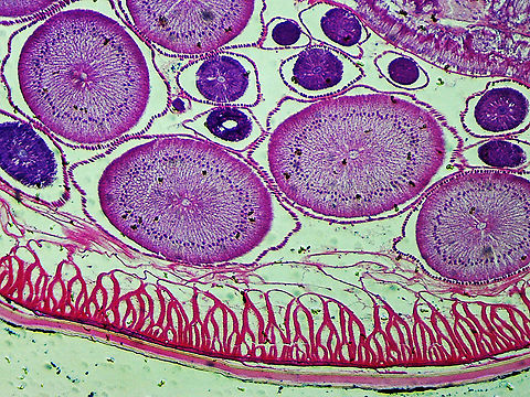 Roundworm Ovaries Cross-section (Female) - Ascaris lumbricoides Ascaris lumbricoides is a large roundworm that infects humans. It grows to 35 cm (14 in)!!

It causes ascariasis, which is a Neglected Tropical Disease (NTG). Worldwide, approximately 1 billion people are infected with this nematode, with infection being more prevalent in tropical areas where sanitation is poor. It infects humans via the fecal-oral route...eggs are shed in feces and then get ingested. Hygiene is crucial to preventing the spread of this disease because it is one of the most difficult pathogens in the world to kill (the eggs can survive several years!).

*Microscope slide; cross-section
https://www.jungledragon.com/image/118183/roundworm_female_with_labels_-_ascaris_lumbricoides.html
https://www.jungledragon.com/image/118184/roundworm_female_-_ascaris_lumbricoides.html
https://www.jungledragon.com/image/118185/roundworm_uterus_cross-section_female_-_ascaris_lumbricoides.html
https://www.jungledragon.com/image/118187/roundworm_ovary_cross-section_female_-_ascaris_lumbricoides.html
https://www.jungledragon.com/image/118186/roundworm_ovaries_cross-section_female_-_ascaris_lumbricoides.html Ascaris lumbricoides