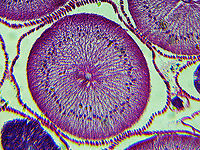 Roundworm Ovary Cross-section (Female) - Ascaris lumbricoides Ascaris lumbricoides is a large roundworm that infects humans. It grows to 35 cm (14 in)!!<br />
<br />
It causes ascariasis, which is a Neglected Tropical Disease (NTG). Worldwide, approximately 1 billion people are infected with this nematode, with infection being more prevalent in tropical areas where sanitation is poor. It infects humans via the fecal-oral route...eggs are shed in feces and then get ingested. Hygiene is crucial to preventing the spread of this disease because it is one of the most difficult pathogens in the world to kill (the eggs can survive several years!).<br />
<br />
*Microscope slide; cross-section<br />
https://www.jungledragon.com/image/118183/roundworm_female_with_labels_-_ascaris_lumbricoides.html<br />
https://www.jungledragon.com/image/118184/roundworm_female_-_ascaris_lumbricoides.html<br />
https://www.jungledragon.com/image/118185/roundworm_uterus_cross-section_female_-_ascaris_lumbricoides.html<br />
https://www.jungledragon.com/image/118187/roundworm_ovary_cross-section_female_-_ascaris_lumbricoides.html<br />
https://www.jungledragon.com/image/118186/roundworm_ovaries_cross-section_female_-_ascaris_lumbricoides.html Ascaris lumbricoides,Geotagged,Summer