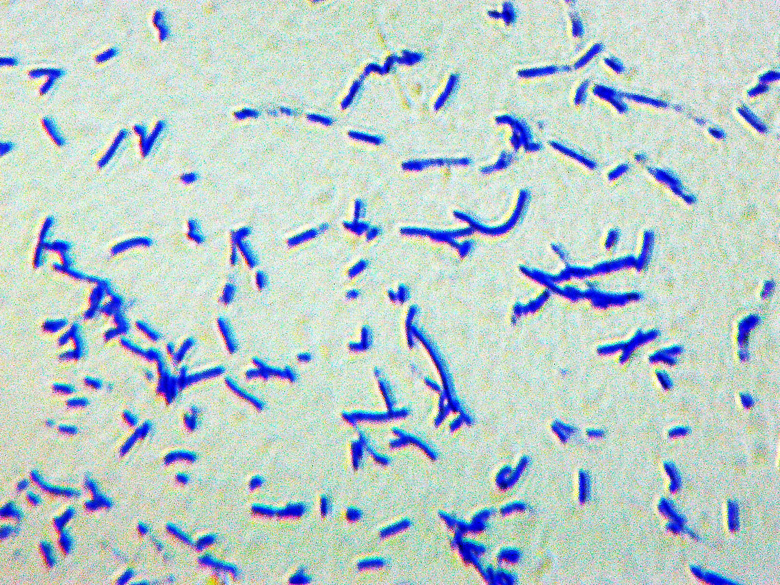 Bacteria - Bacillus anthracis Sorry for the poor quality photo, but these bacteria are tiny and my scope isn&#039;t powerful enough.  The rods are only 3-5 um long.<br />
<br />
As innocent as these bacteria may appear, they are not. Bacillus anthracis is the bacterium that causes anthrax -- a deadly disease. The infection causes black, necrotic lesions on the face, neck, arms, or hands. If untreated, it is usually fatal, causing fever, chest pain, diaphoresis, body aches, and death. <br />
<br />
*Whole mount microscope slide Bacillus,Bacillus anthracis,Gram-positive,anthrax,bacteria,pathogen,rod-shaped bacteria,zoonosis