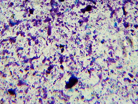 Tuberculosis - Mycobacterium tuberculosis Mycobacterium tuberculosis is the agent that causes tuberculosis in humans.  It is an airborne disease that infects the respiratory system.  It easily gets passed by sneezing, coughing, and talking. 

It is currently the deadliest infectious agent worldwide, affecting nearly 2 billion people.

*Microscope slide, w.m. Mycobacteriaceae,Mycobacterium tuberculosis,bacteria,mycobacterium tuberculosis,pathogen,pathogenic bacteria,tuberculosis