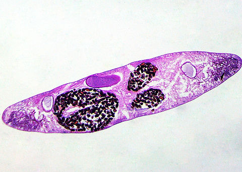 Chinese Liver Fluke - Clonorchis sinensis Chinese liver flukes infect fish-eating mammals, including humans. In humans, it infects the common bile duct and gall bladder, feeding on bile. The fluke passes its lifecycle in three different hosts (freshwater snails as first intermediate hosts, freshwater fish as second intermediate host, and mammals as definitive hosts).

Infection causes jaundice, indigestion, biliary inflammation, bile duct obstruction, liver cirrhosis, cholangiocarcinoma, and hepatic carcinoma.

*cross-section microscope slide Clonorchis,Clonorchis sinensis,Geotagged,Trematoda,United States,Winter,chinese liver fluke,fluke,liver fluke