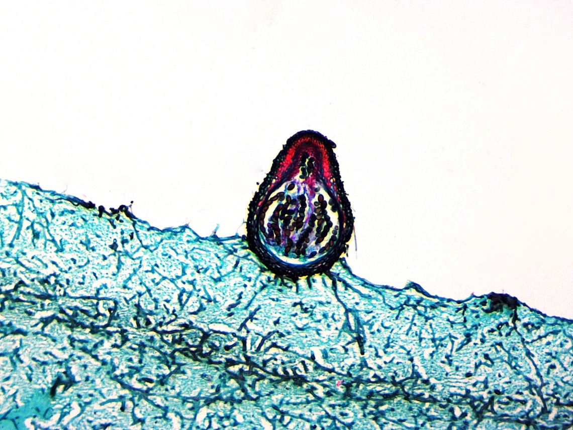 Sordaria fimicola This is a longitudinal section of S. fimicola (showing the perithecia), a microscopic fungus. It's commonly found in the feces of herbivores and can negatively impact the growth of other fungi, in addition to certain plants.<br />
<br />
*l.s. microscope slide<br />
<figure class="photo"><a href="https://www.jungledragon.com/image/128755/sordaria_fimicola.html" title="Sordaria fimicola"><img src="https://s3.amazonaws.com/media.jungledragon.com/images/3232/128755_thumb.jpg?AWSAccessKeyId=05GMT0V3GWVNE7GGM1R2&Expires=1759968010&Signature=lYUcrP5nhHRmEiIP5NlHyR1dsJM%3D" width="200" height="160" alt="Sordaria fimicola This is a longitudinal section of S. fimicola (showing the perithecia), a microscopic fungus. It's commonly found in the feces of herbivores and can negatively impact the growth of other fungi, in addition to certain plants.<br />
<br />
*l.s. microscope slide<br />
https://www.jungledragon.com/image/128754/sordaria_fimicola.html Geotagged,Sordaria fimicola,United States,Winter" /></a></figure> Geotagged,Sordaria,Sordaria fimicola,Summer,United States,Winter,fungus