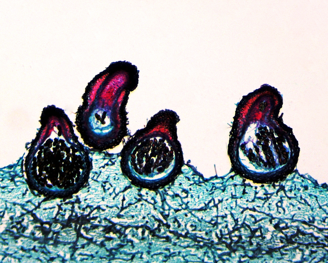 Sordaria fimicola This is a longitudinal section of S. fimicola (showing the perithecia), a microscopic fungus. It's commonly found in the feces of herbivores and can negatively impact the growth of other fungi, in addition to certain plants.<br />
<br />
*l.s. microscope slide<br />
<figure class="photo"><a href="https://www.jungledragon.com/image/128754/sordaria_fimicola.html" title="Sordaria fimicola"><img src="https://s3.amazonaws.com/media.jungledragon.com/images/3232/128754_thumb.jpg?AWSAccessKeyId=05GMT0V3GWVNE7GGM1R2&Expires=1759968010&Signature=KcfikHGIxcxBHgZZ2DIxrDYGkDE%3D" width="200" height="150" alt="Sordaria fimicola This is a longitudinal section of S. fimicola (showing the perithecia), a microscopic fungus. It's commonly found in the feces of herbivores and can negatively impact the growth of other fungi, in addition to certain plants.<br />
<br />
*l.s. microscope slide<br />
https://www.jungledragon.com/image/128755/sordaria_fimicola.html Geotagged,Sordaria,Sordaria fimicola,Summer,United States,Winter,fungus" /></a></figure> Geotagged,Sordaria fimicola,United States,Winter