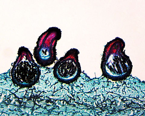 Sordaria fimicola This is a longitudinal section of S. fimicola (showing the perithecia), a microscopic fungus. It's commonly found in the feces of herbivores and can negatively impact the growth of other fungi, in addition to certain plants.

*l.s. microscope slide
https://www.jungledragon.com/image/128754/sordaria_fimicola.html Geotagged,Sordaria fimicola,United States,Winter