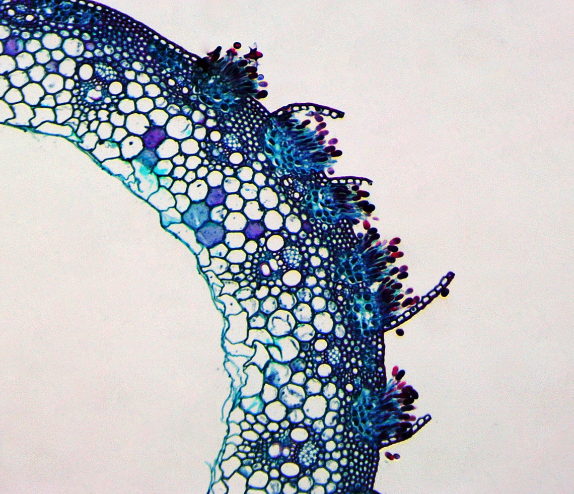 Stem Rust - Puccinia graminis Puccinia graminis is a fungus that causes significant disease in cereal crops. Crop species that are affected include bread wheat, durum wheat, barley, and triticale.<br />
<br />
*microscope slide Geotagged,Puccinia,Puccinia graminis,Stem rust,United States,Winter,black rust,cereal rust,fungus,red dust,red rust,rust