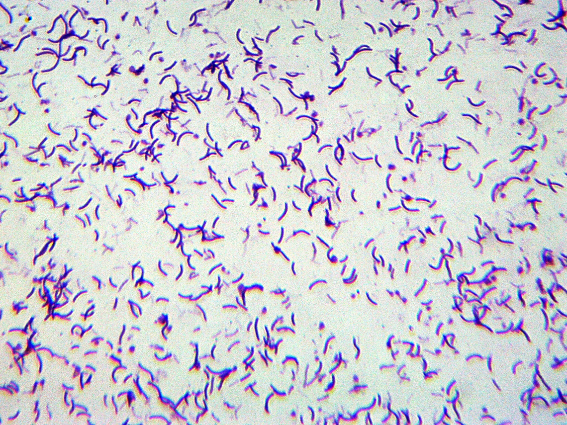 Shigella dysenteriae These tiny beasties cause an intestinal infection called bacillary dysentery. Infections are contracted through poor water and food quality, unsanitary cooking conditions, and improper hygiene. Symptoms of disease include diarrhea, malnutrition, rectal prolapse, coma, reactive arthritis, and central nervous system problems. Severe, untreated infections can lead to anemia, thrombocytopenia, kidney failure, and death. It has a 20% mortality rate.<br />
<br />
*w.m. microscope slide Geotagged,Shigella dysenteriae,United States,Winter,bacteria,gram negative bacteria,shigella,shigellosis
