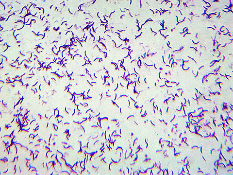 Shigella dysenteriae These tiny beasties cause an intestinal infection called bacillary dysentery. Infections are contracted through poor water and food quality, unsanitary cooking conditions, and improper hygiene.  Symptoms of disease include diarrhea, malnutrition, rectal prolapse, coma, reactive arthritis, and central nervous system problems. Severe, untreated infections can lead to anemia, thrombocytopenia, kidney failure, and death. It has a 20% mortality rate.

 *w.m. microscope slide Geotagged,Shigella dysenteriae,United States,Winter,bacteria,gram negative bacteria,shigella,shigellosis