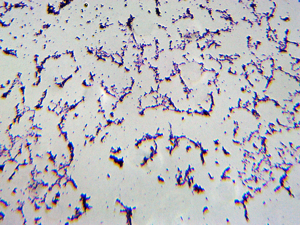 Spirillum volutans This is such a bad slide of this bacteria that I may redo it and upload a new image. I&#039;ll leave this one here for now to document the species.<br />
<br />
*w.m. microscope slide Geotagged,Spirillum,Spirillum volutans,United States,Winter,bacteria