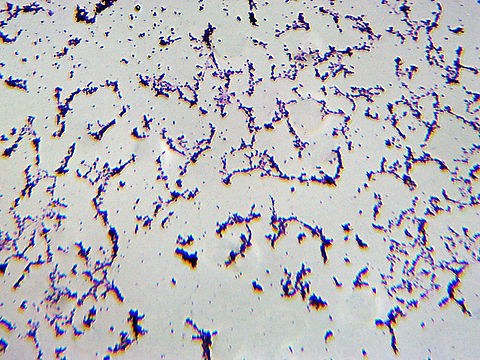 Spirillum volutans This is such a bad slide of this bacteria that I may redo it and upload a new image. I'll leave this one here for now to document the species.

*w.m. microscope slide Geotagged,Spirillum,Spirillum volutans,United States,Winter,bacteria