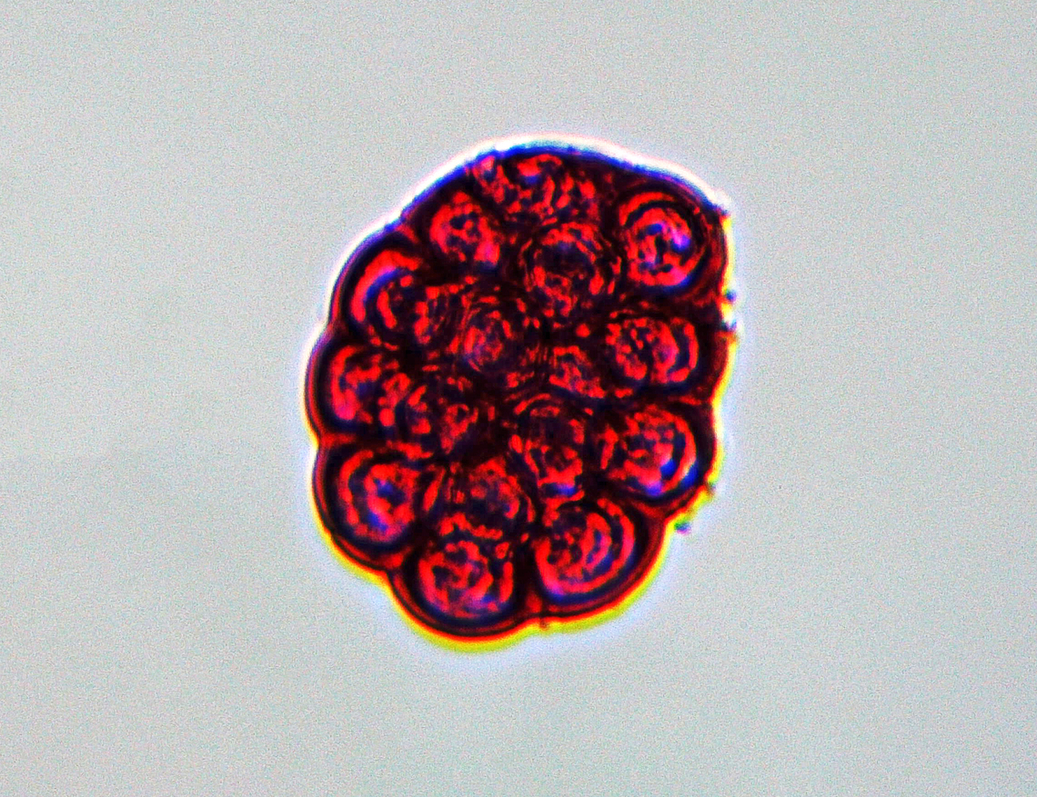 Flea Tapeworm Eggs - Dipylidium caninum These are the eggs of the flea tapeworm. <br />
<br />
This parasite infects organisms afflicted with fleas and lice, including dogs, cats, and human pet-owners, especially children. It occurs worldwide, and is the most common tapeworm of dogs and is also relatively common in cats.<br />
<br />
Infections can be asymptomatic, but when symptoms occur, they include: diarrhea, abdominal colic, constipation, rectal itching, and pain due to emerging proglottids through the anal cavity. Yuck.<br />
<br />
*microscope slide Dipylidium,Dipylidium caninum,Geotagged,United States,Winter,cestode,cucumber tapeworm,diplydiasis,double-pored tapeworm,eggs,tapeworm