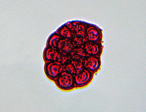 Flea Tapeworm Eggs - Dipylidium caninum These are the eggs of the flea tapeworm. 

This parasite infects organisms afflicted with fleas and lice, including dogs, cats, and human pet-owners, especially children. It occurs worldwide, and is the most common tapeworm of dogs and is also relatively common in cats.

Infections can be asymptomatic, but when symptoms occur, they include: diarrhea, abdominal colic, constipation, rectal itching, and pain due to emerging proglottids through the anal cavity. Yuck.

*microscope slide Dipylidium,Dipylidium caninum,Geotagged,United States,Winter,cestode,cucumber tapeworm,diplydiasis,double-pored tapeworm,eggs,tapeworm